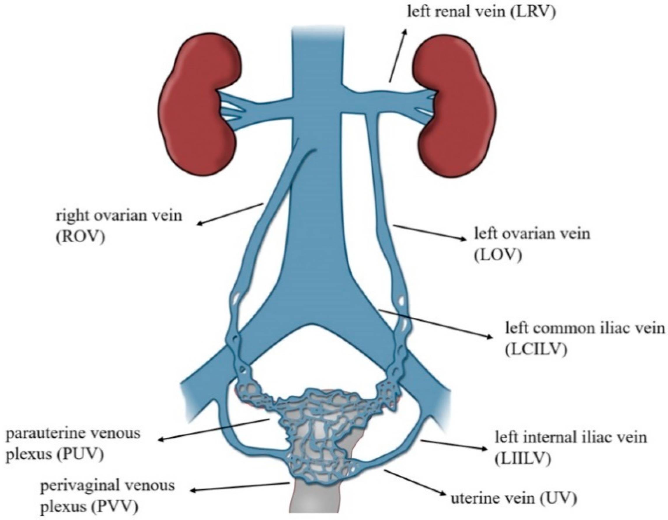 varicele vaselor uterine