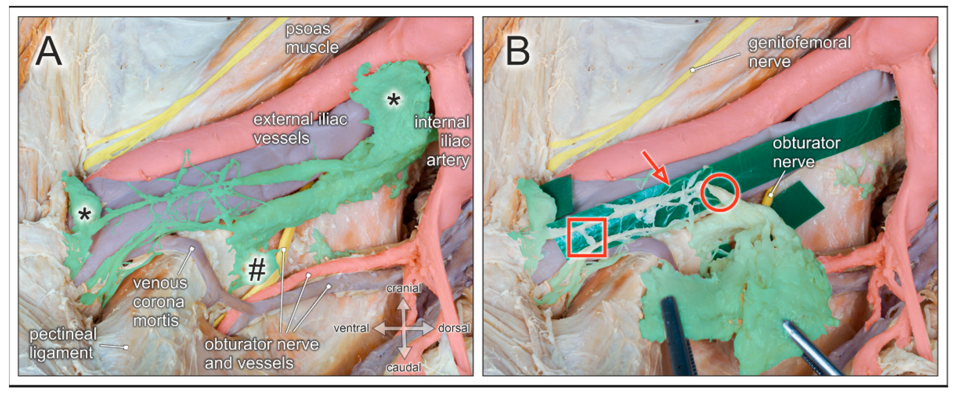 Jcm 10 00708 g007 Jcm 10 00708 g007