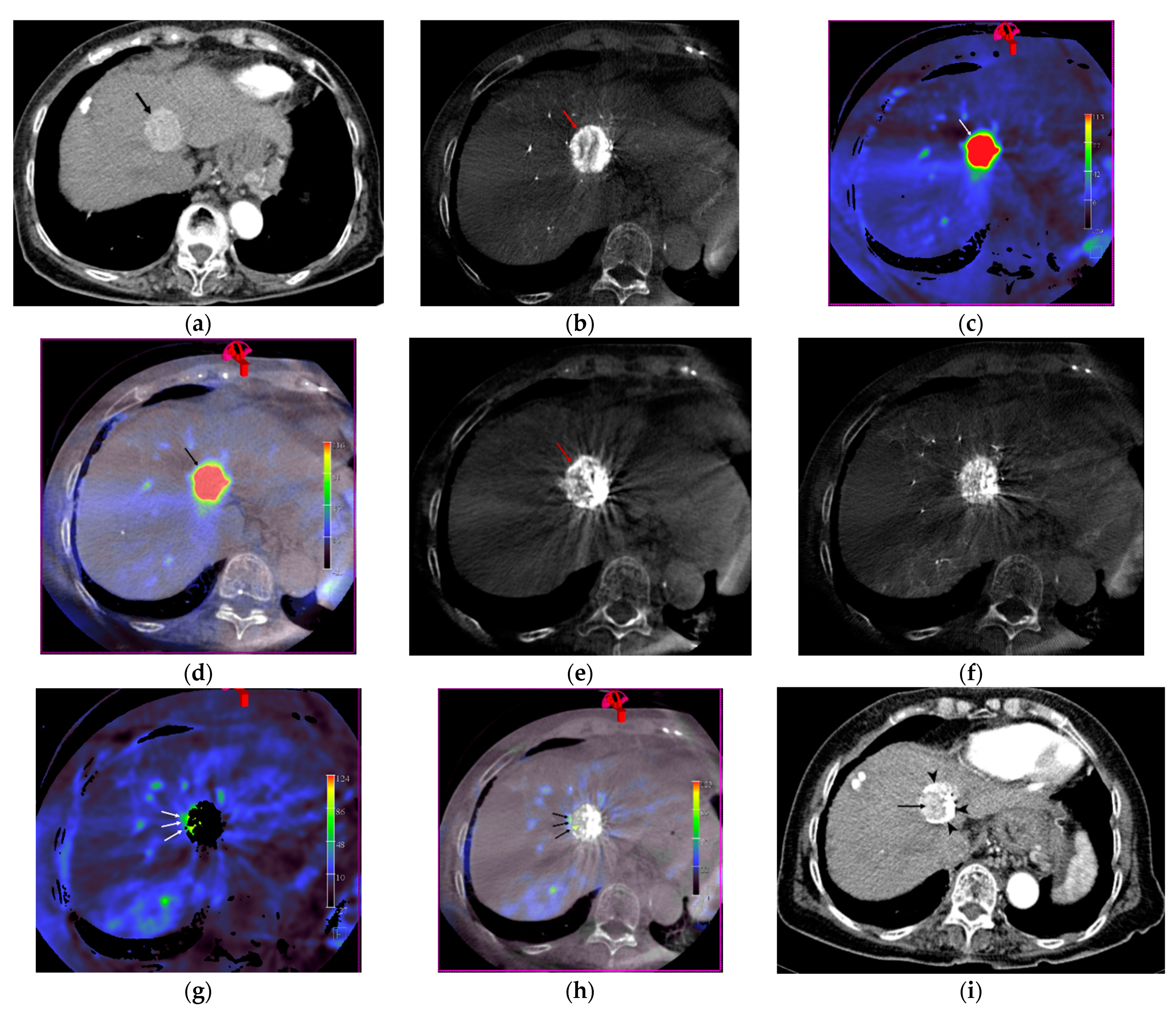 Jcm 10 00713 g002 Jcm 10 00713 g002