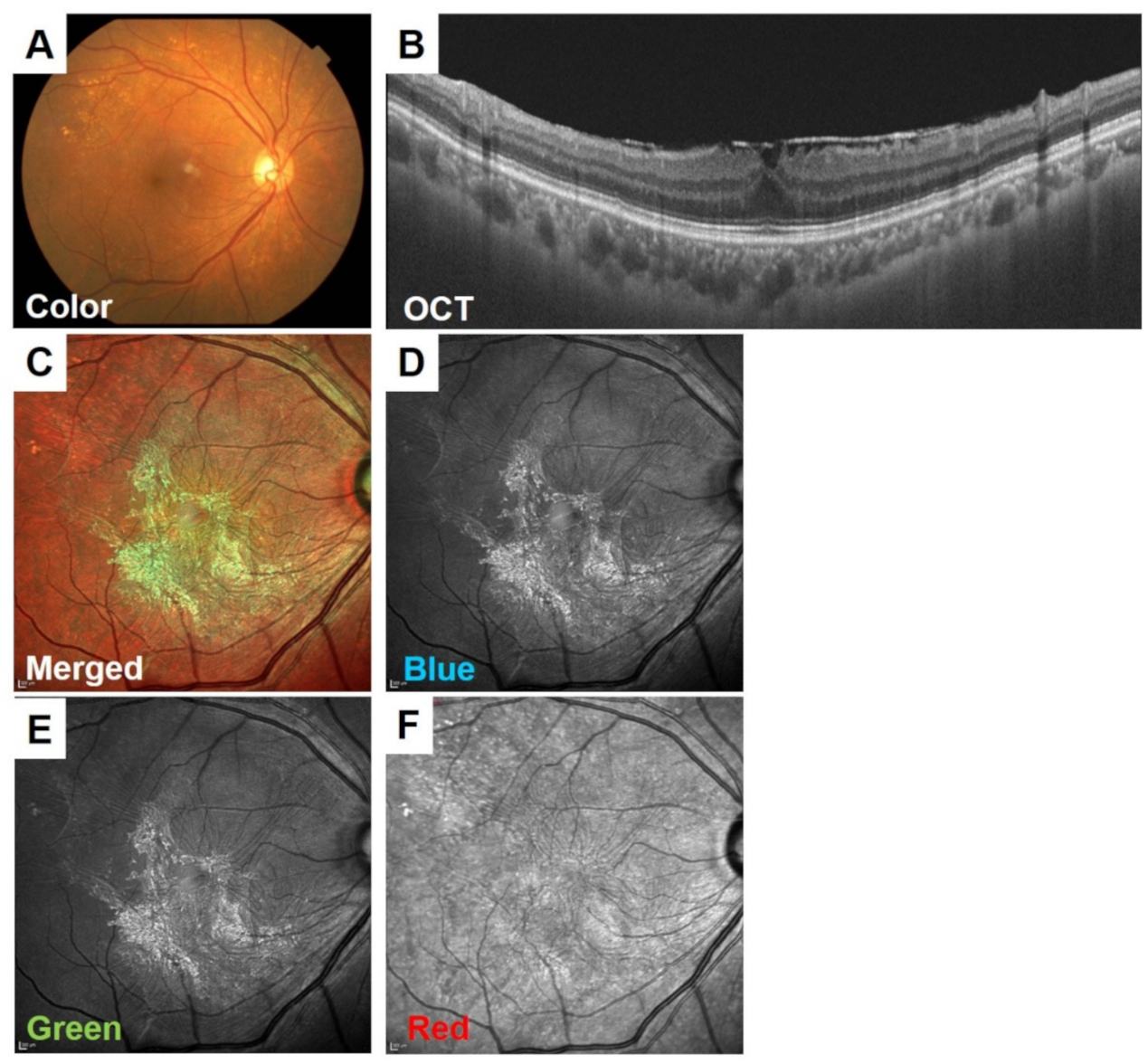 Jcm 10 00718 g007 Jcm 10 00718 g007