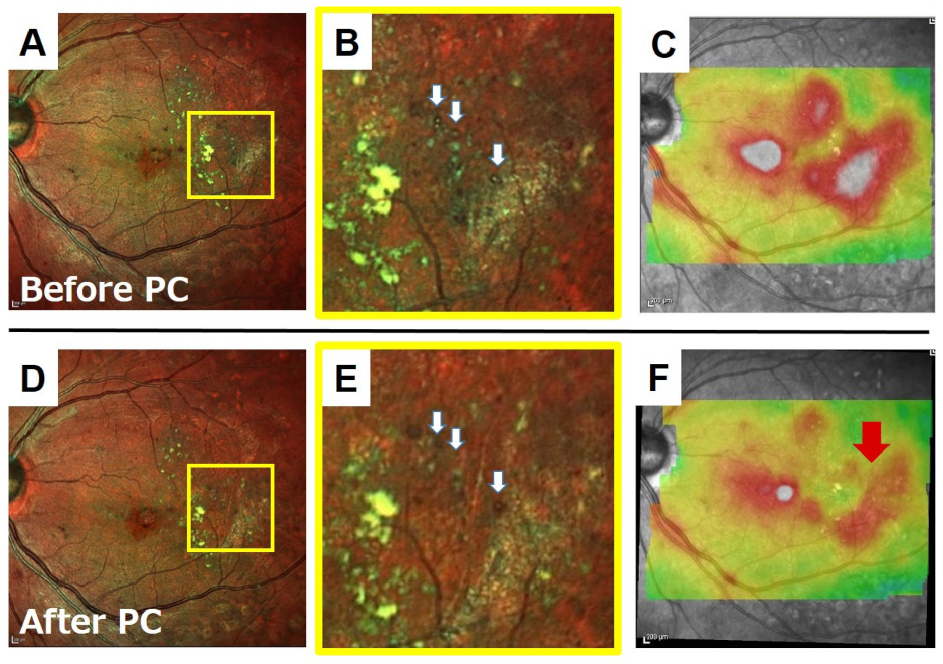 Jcm 10 00718 g008 Jcm 10 00718 g008