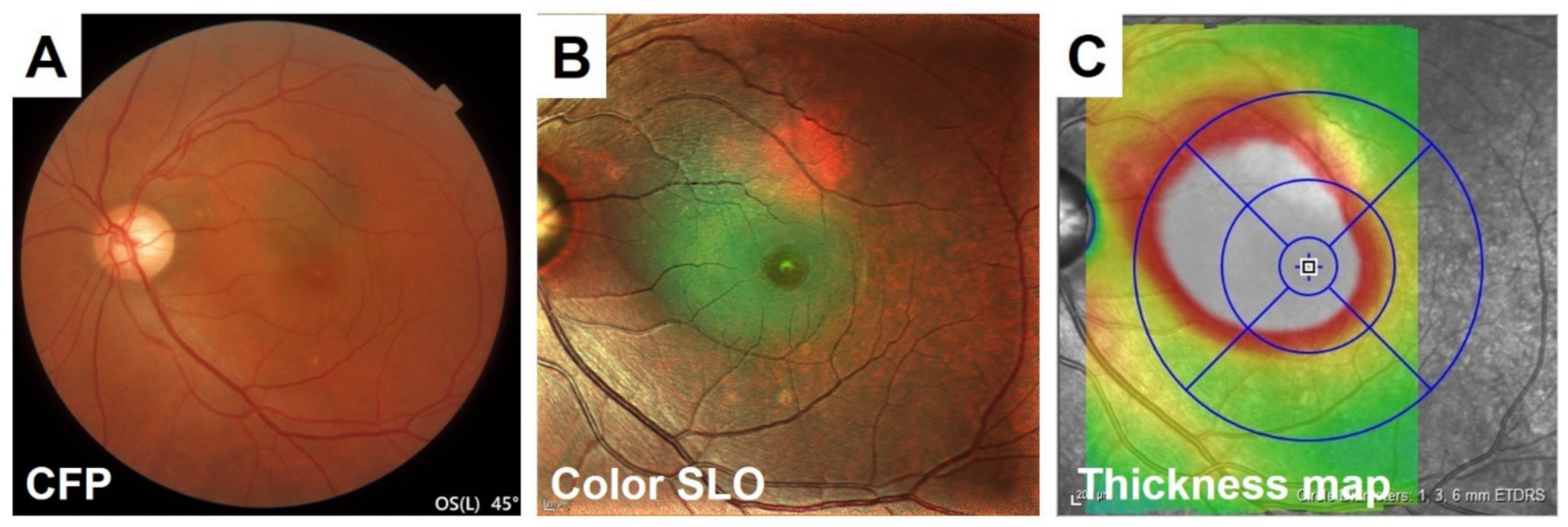 Jcm 10 00718 g010 Jcm 10 00718 g010
