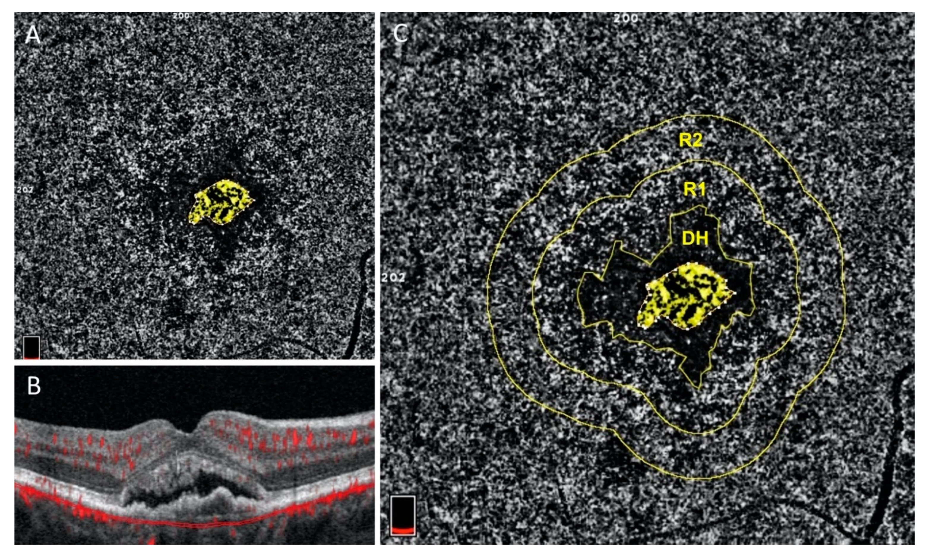 Jcm 10 00751 g004 Jcm 10 00751 g004