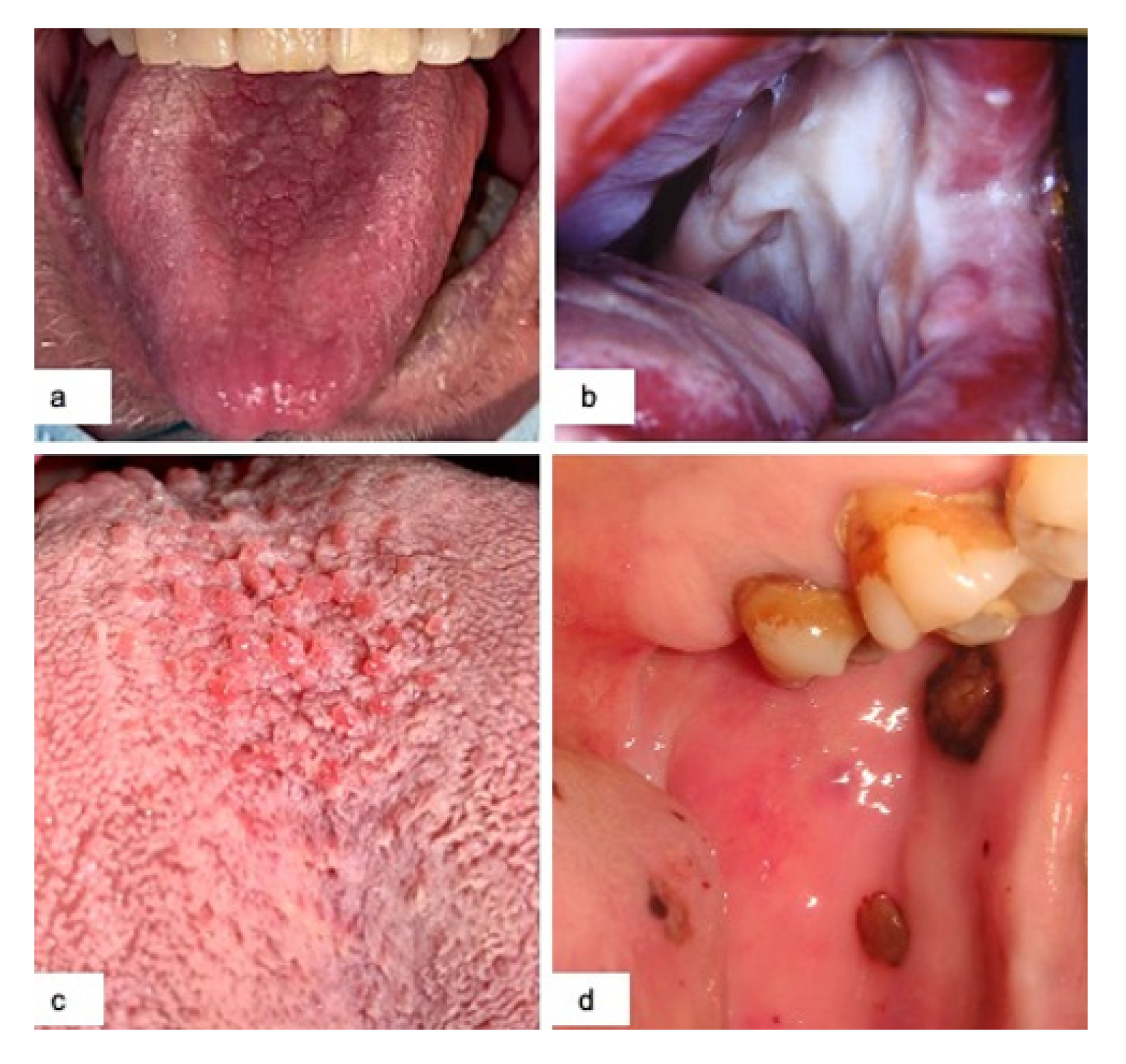 Jcm 10 00757 g002 Jcm 10 00757 g002