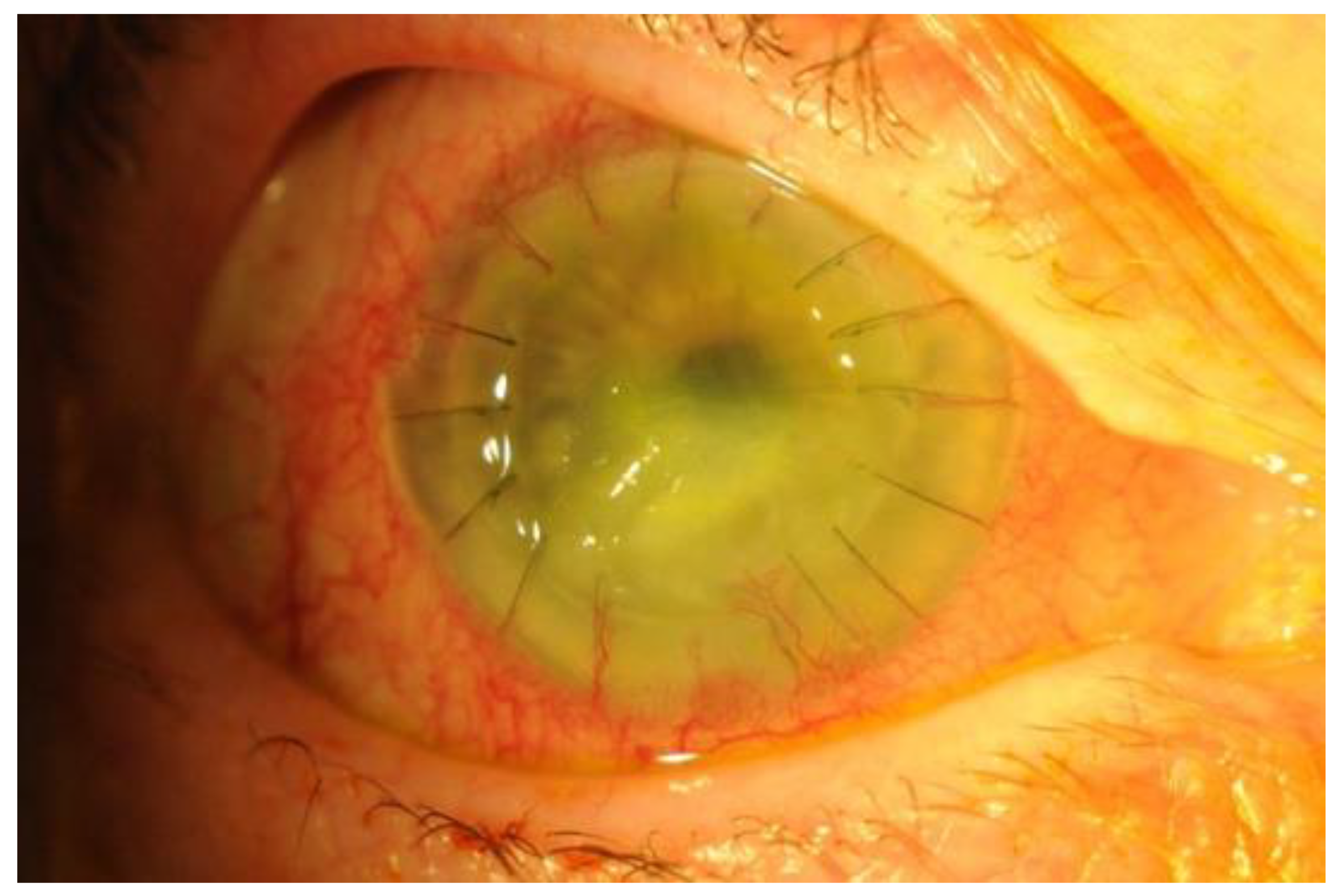 Jcm 10 00758 g003 Jcm 10 00758 g003