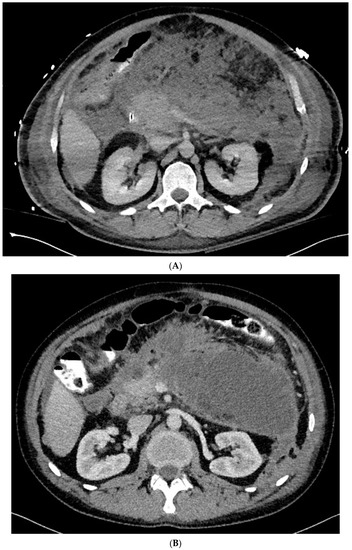 Jcm 10 00761 g001a 550