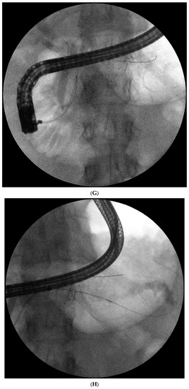 Jcm 10 00761 g001d 550