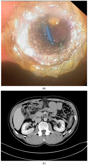 Jcm 10 00761 g001f 550