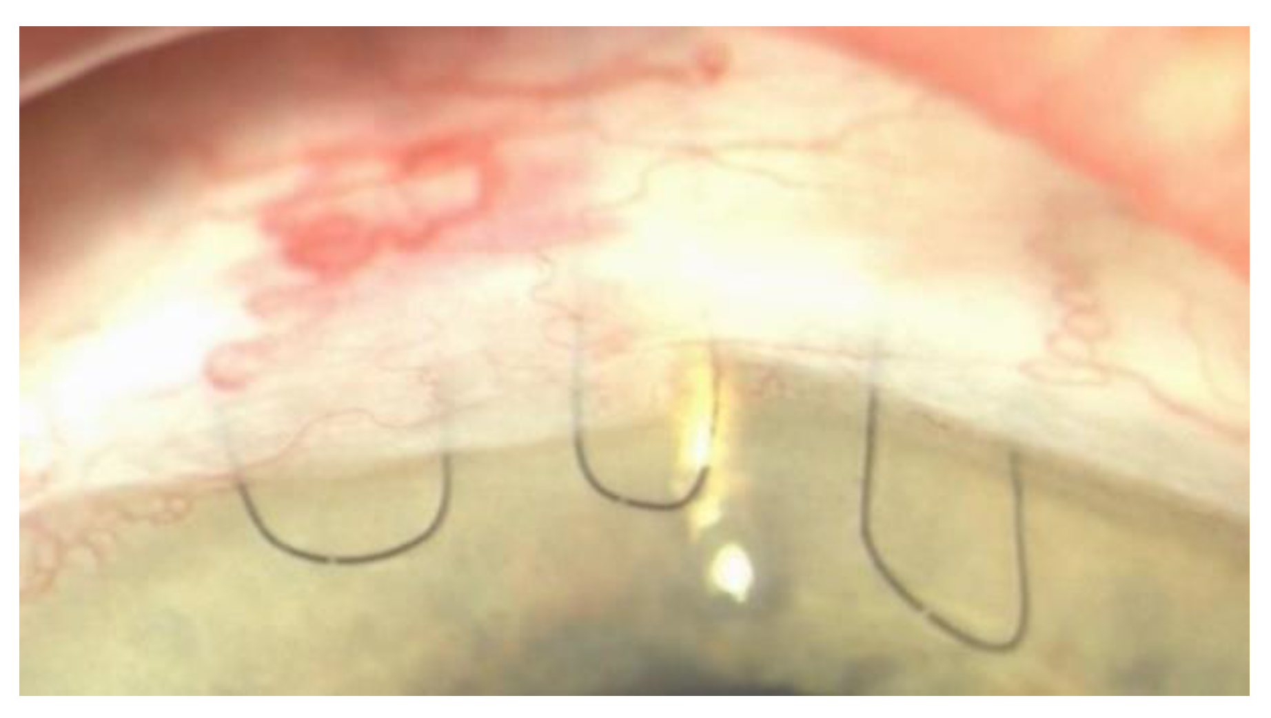 Jcm 10 00774 g001 Jcm 10 00774 g001