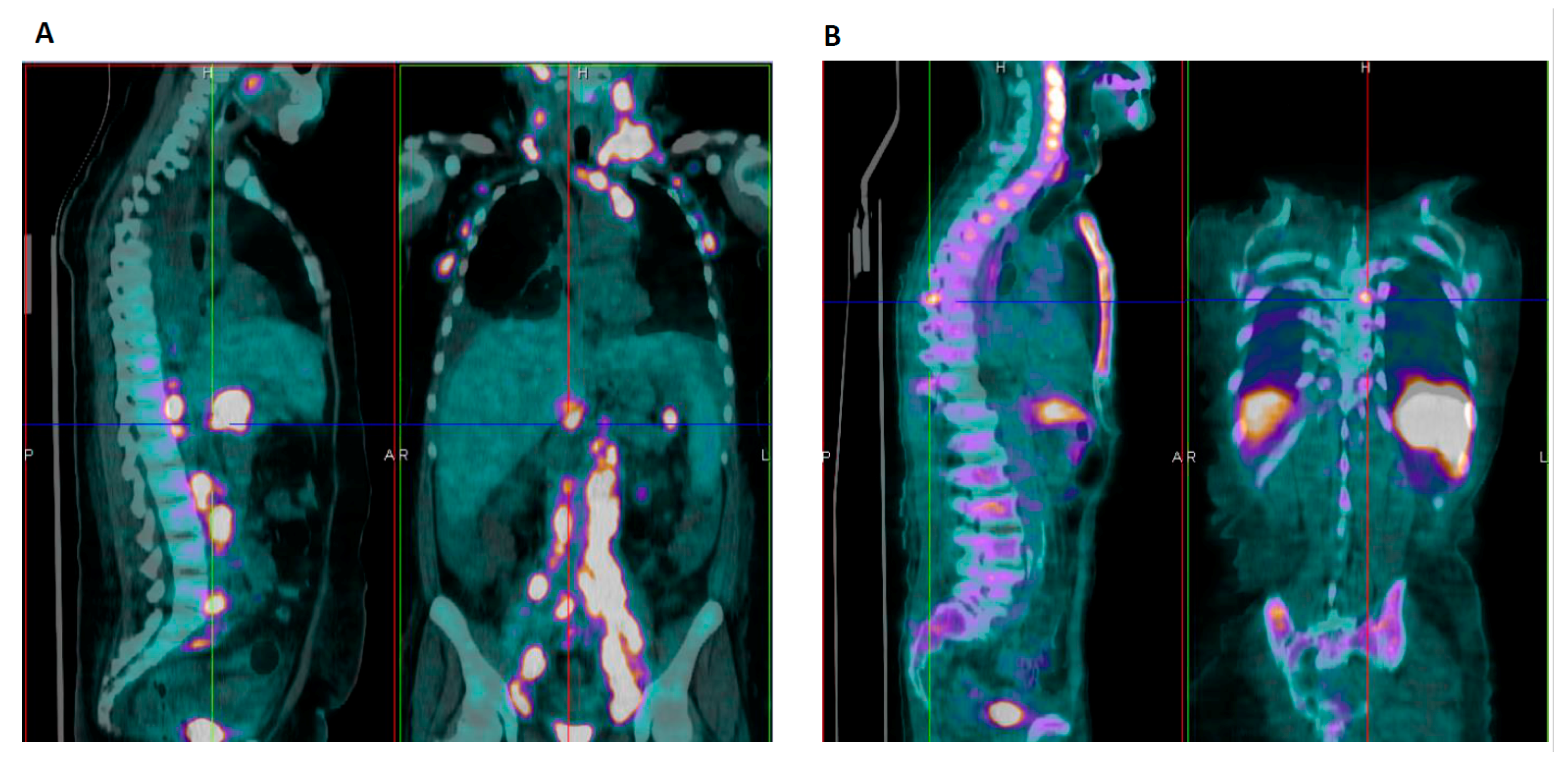 Jcm 10 00870 g002 Jcm 10 00870 g002