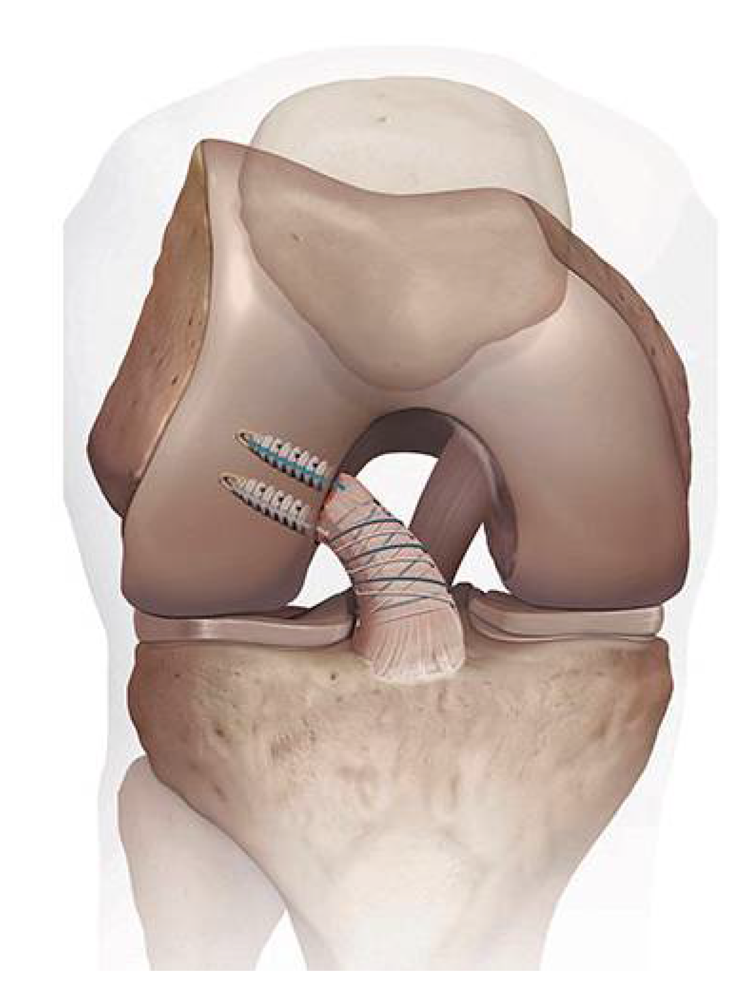 Jcm 10 00912 g003 Jcm 10 00912 g003