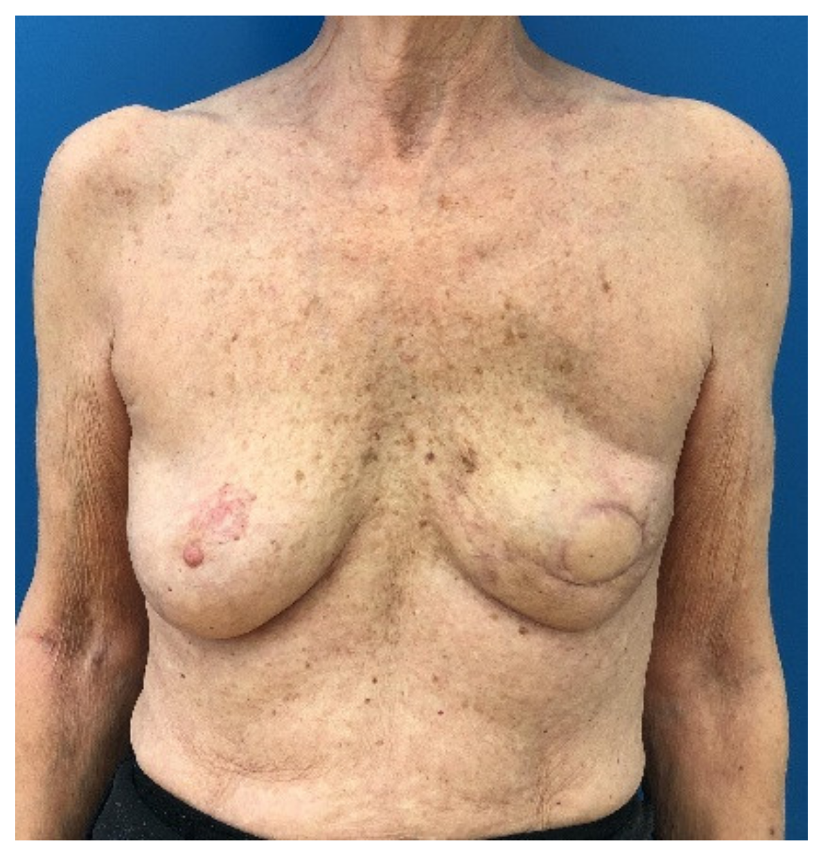 Jcm 10 00926 g003 Jcm 10 00926 g003