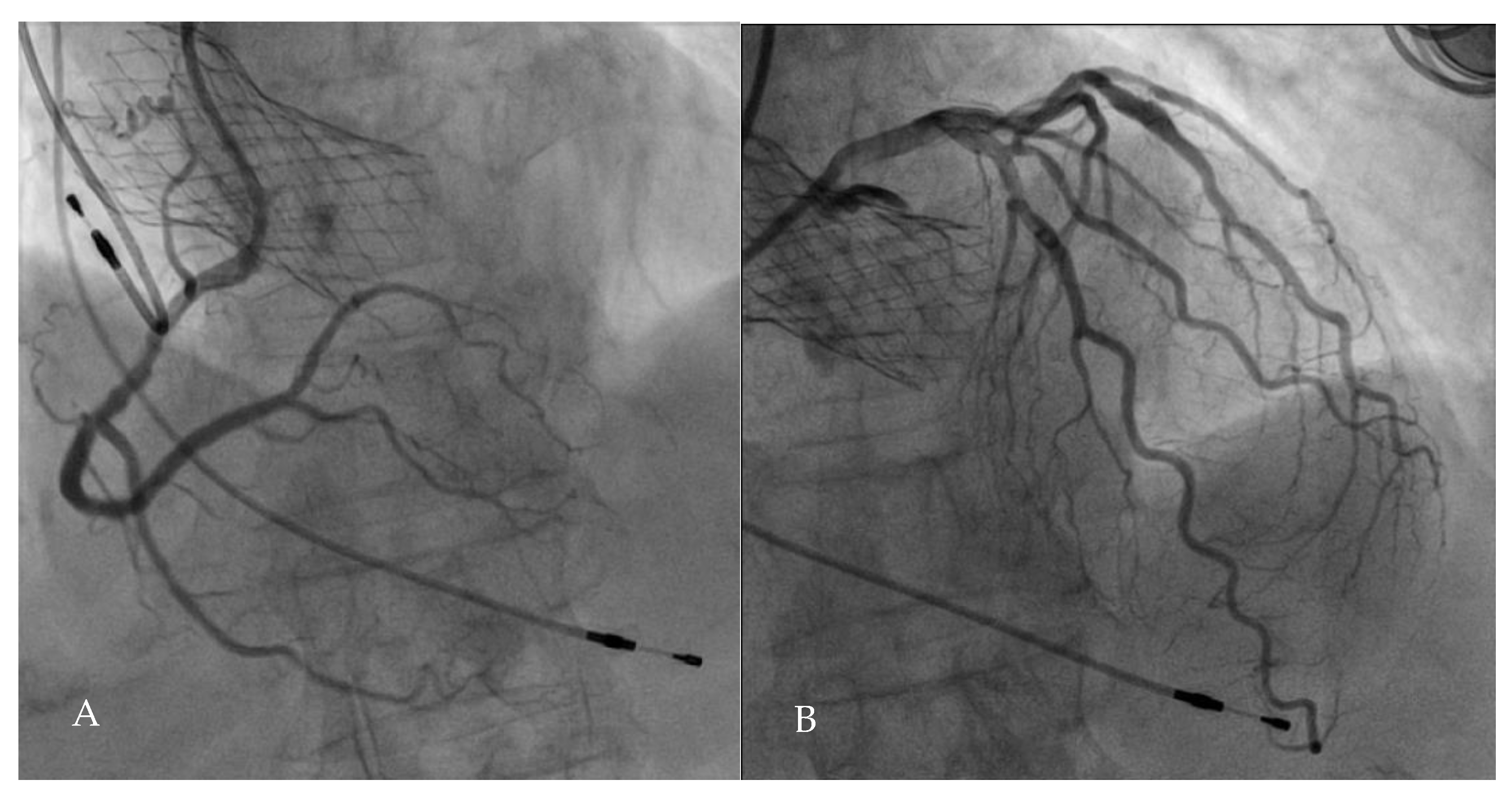 Jcm 10 00946 g004 Jcm 10 00946 g004