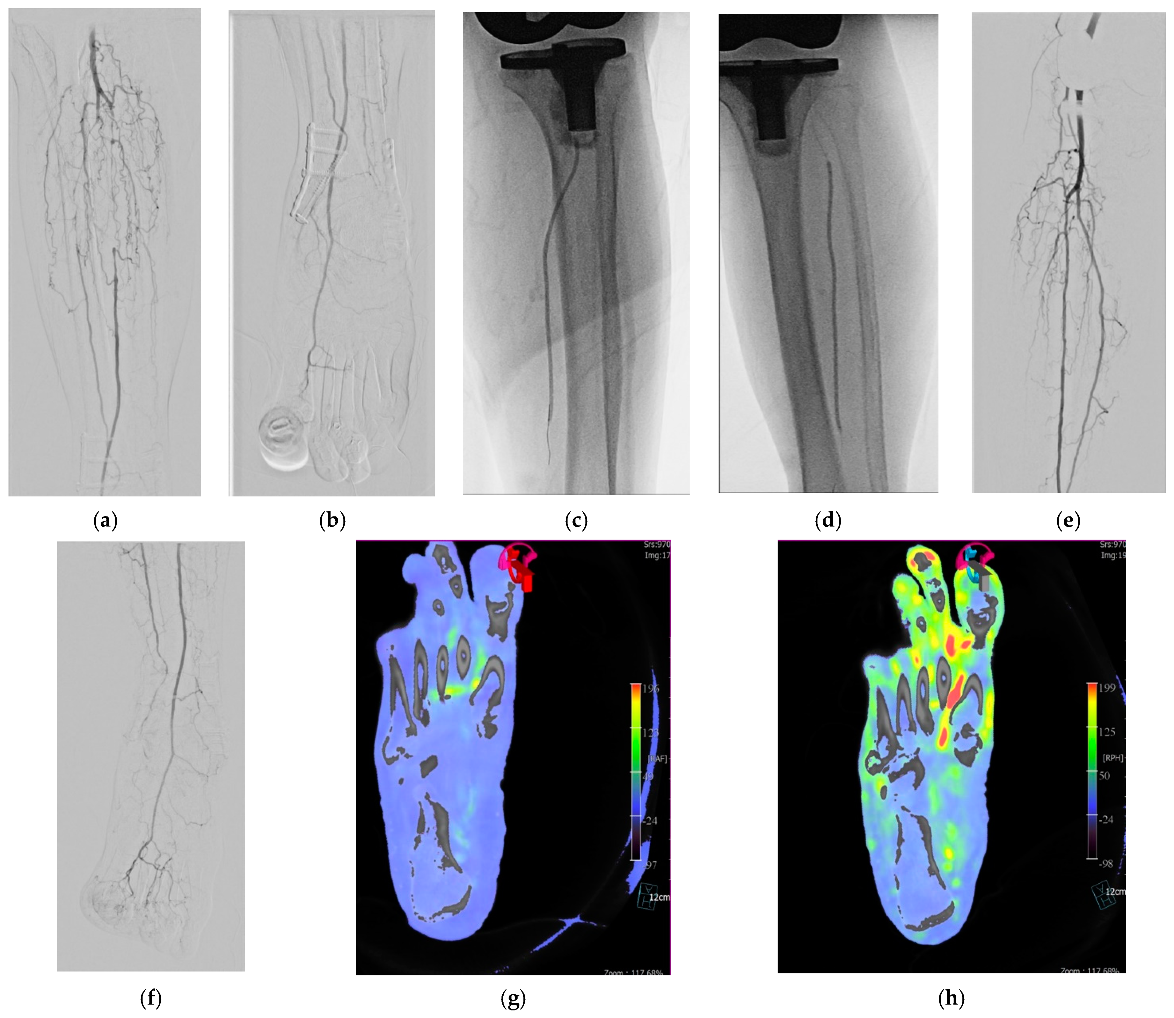 Jcm 10 00947 g001 Jcm 10 00947 g001