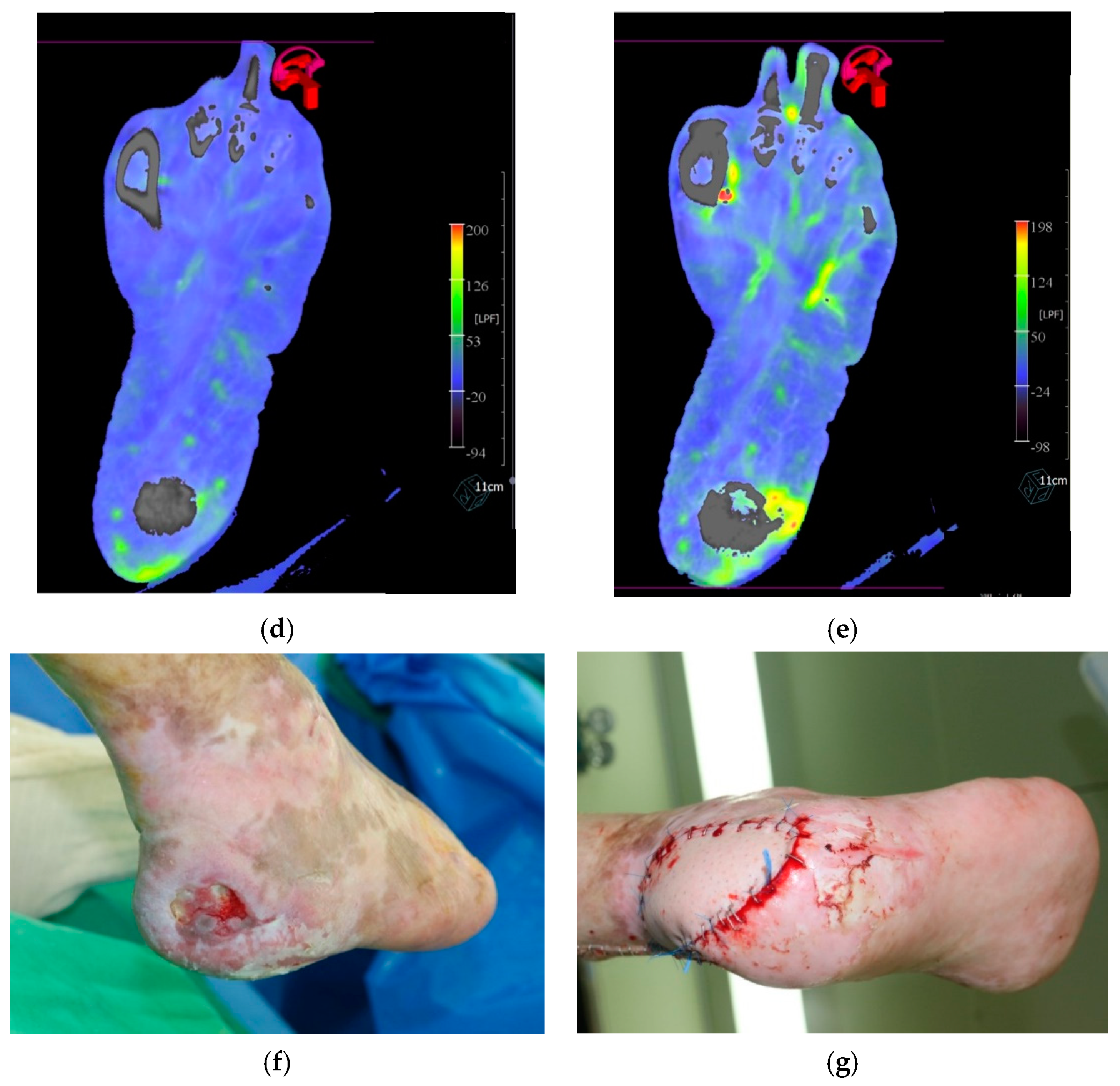 Jcm 10 00947 g002b Jcm 10 00947 g002b