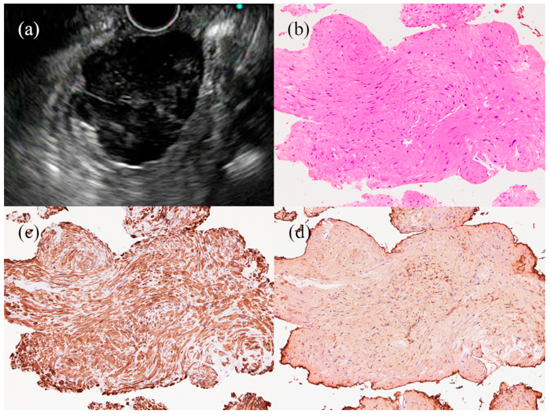 Jcm 10 01076 g004 Jcm 10 01076 g004