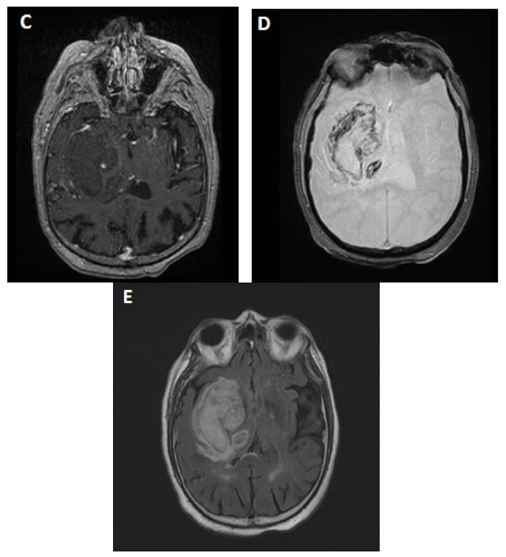 Jcm 10 01086 g002b Jcm 10 01086 g002b