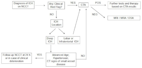 New Insights in Intracerebral Hemorrhage (Frontiers of Neurology and Neuroscience) [ハードカバー] Toyoda， Kazunori? Anderson， Craig S.; Mayer， Stephan A. Spontaneous intracerebral hemorrhage: a review in