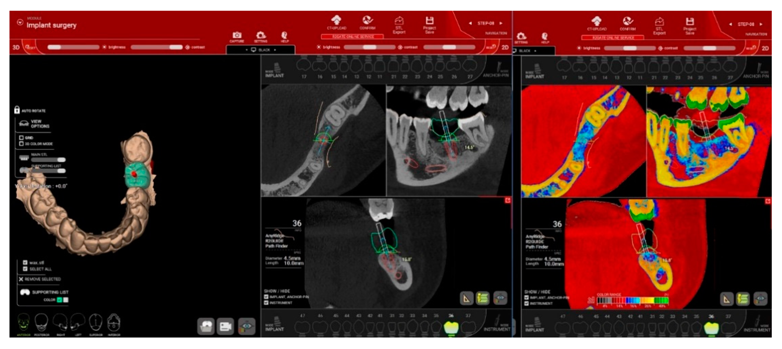 Jcm 10 01102 g003 Jcm 10 01102 g003
