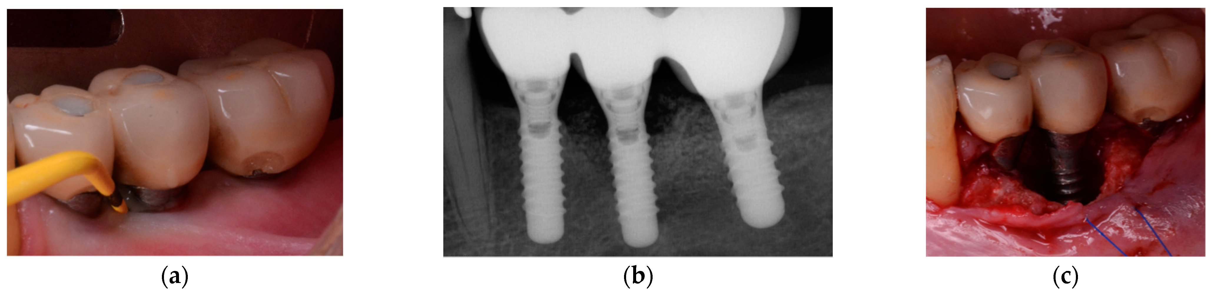 Jcm 10 01107 g001 Jcm 10 01107 g001