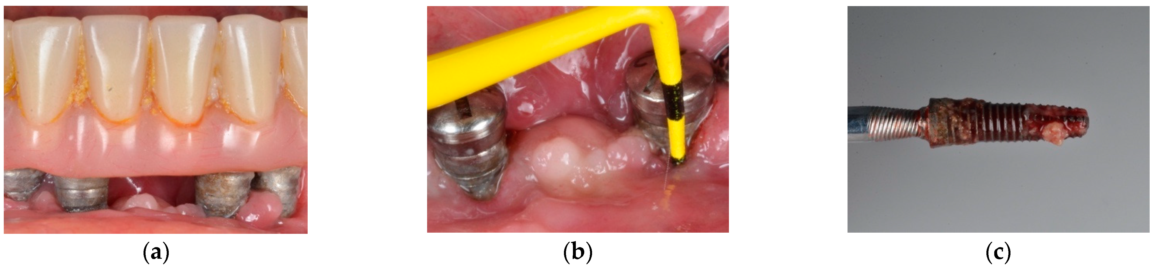 Jcm 10 01107 g003 Jcm 10 01107 g003