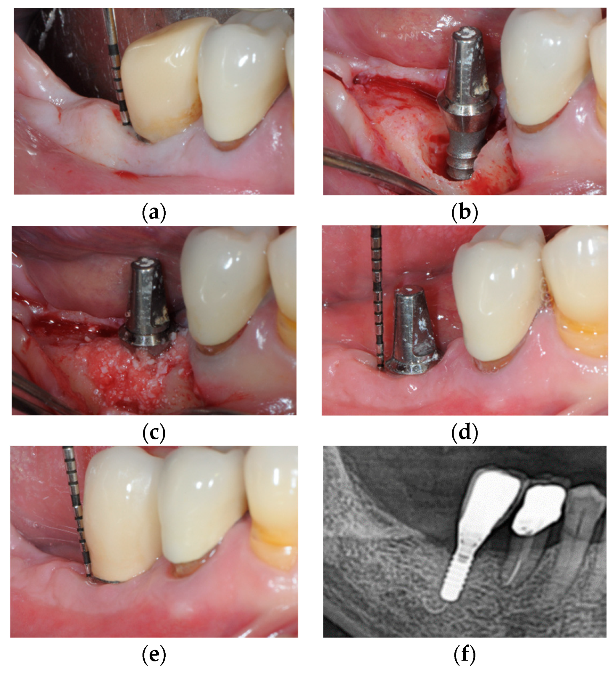Jcm 10 01107 g005 Jcm 10 01107 g005