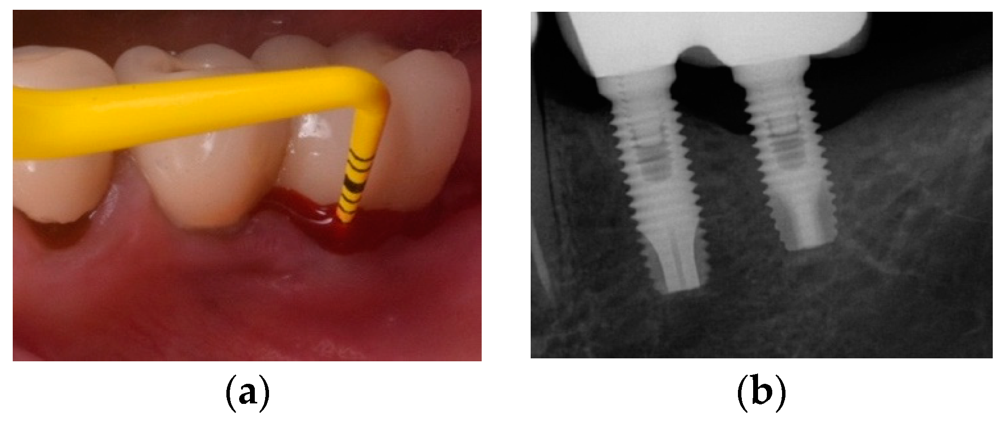 Jcm 10 01107 g006a Jcm 10 01107 g006a