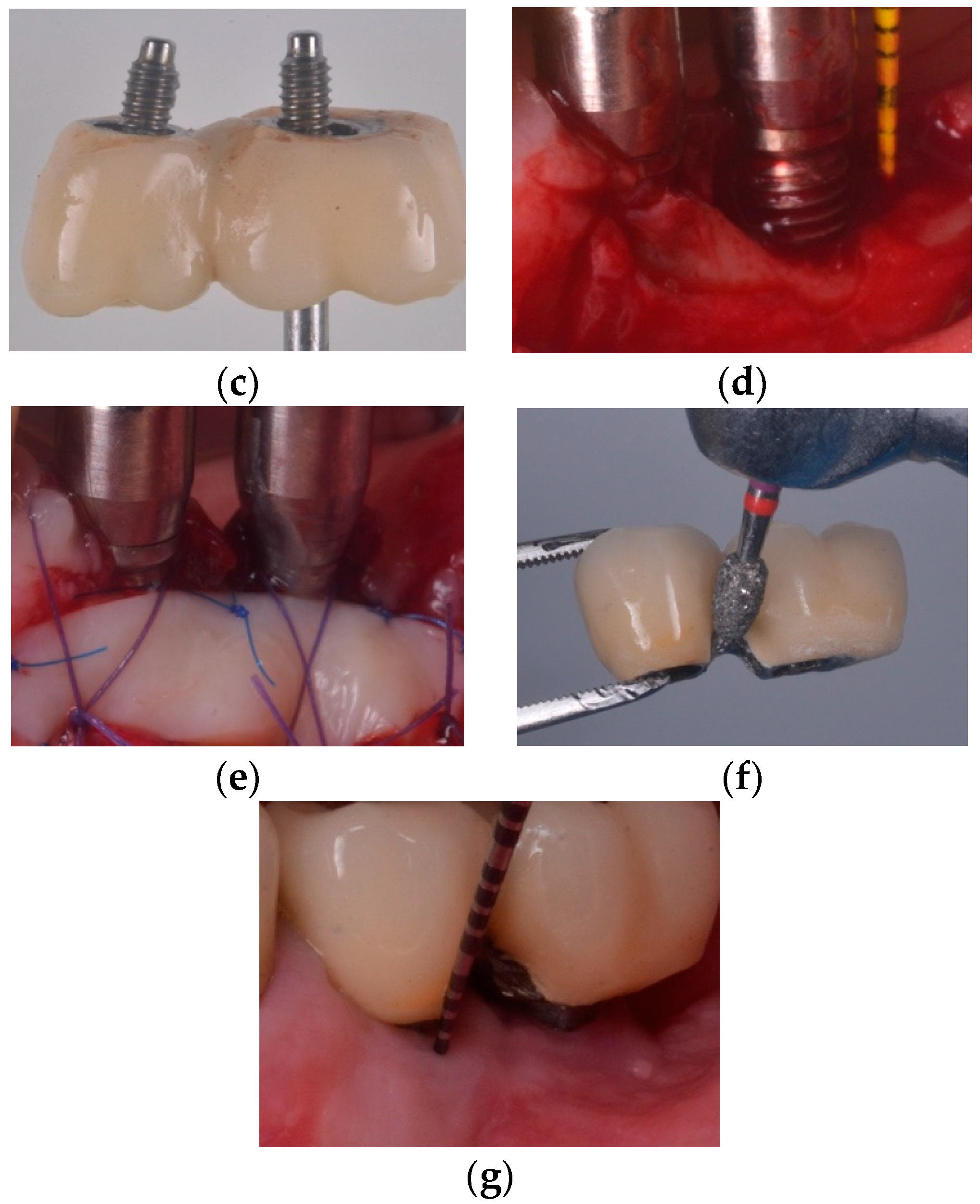 Jcm 10 01107 g006b Jcm 10 01107 g006b