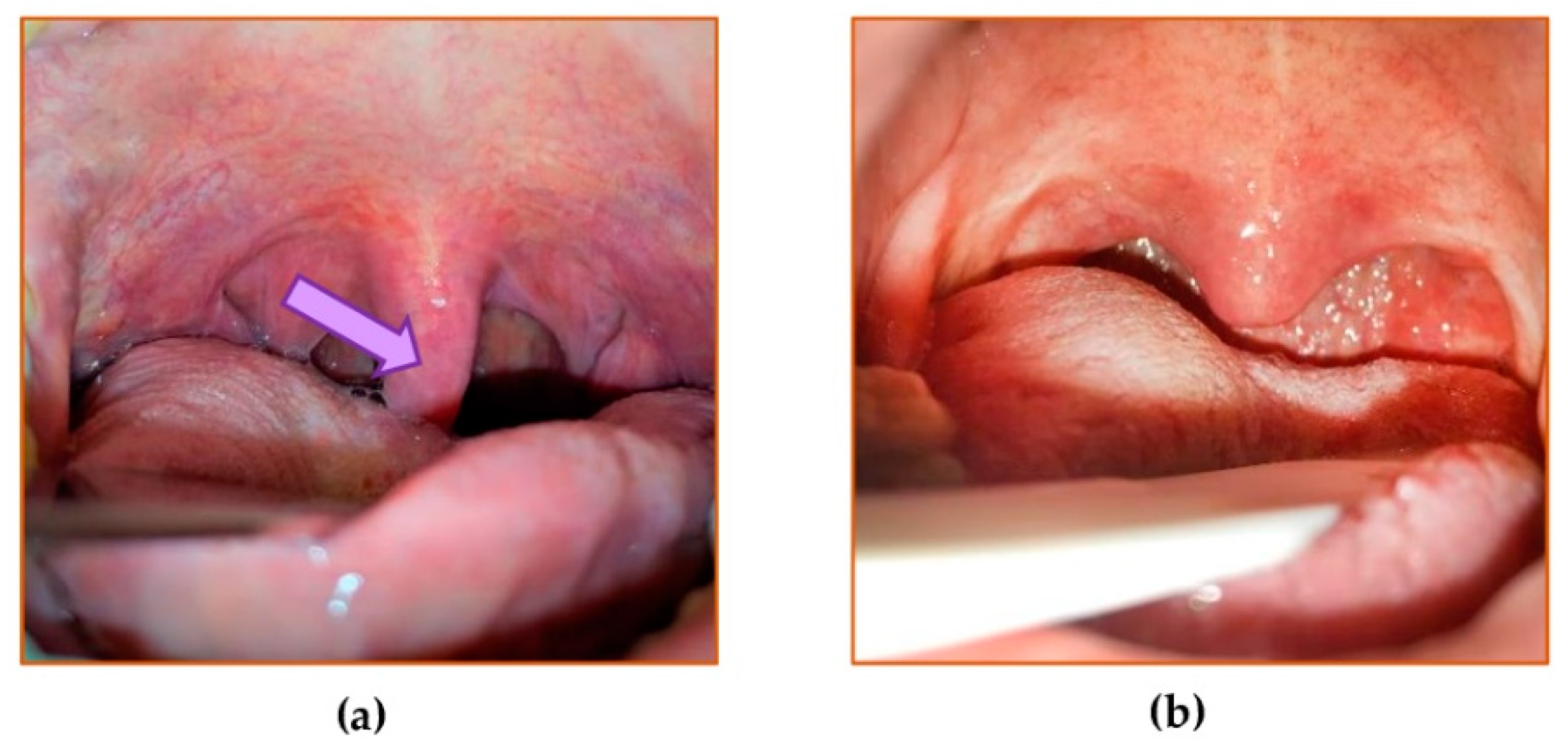 Jcm 10 01132 g001 Jcm 10 01132 g001