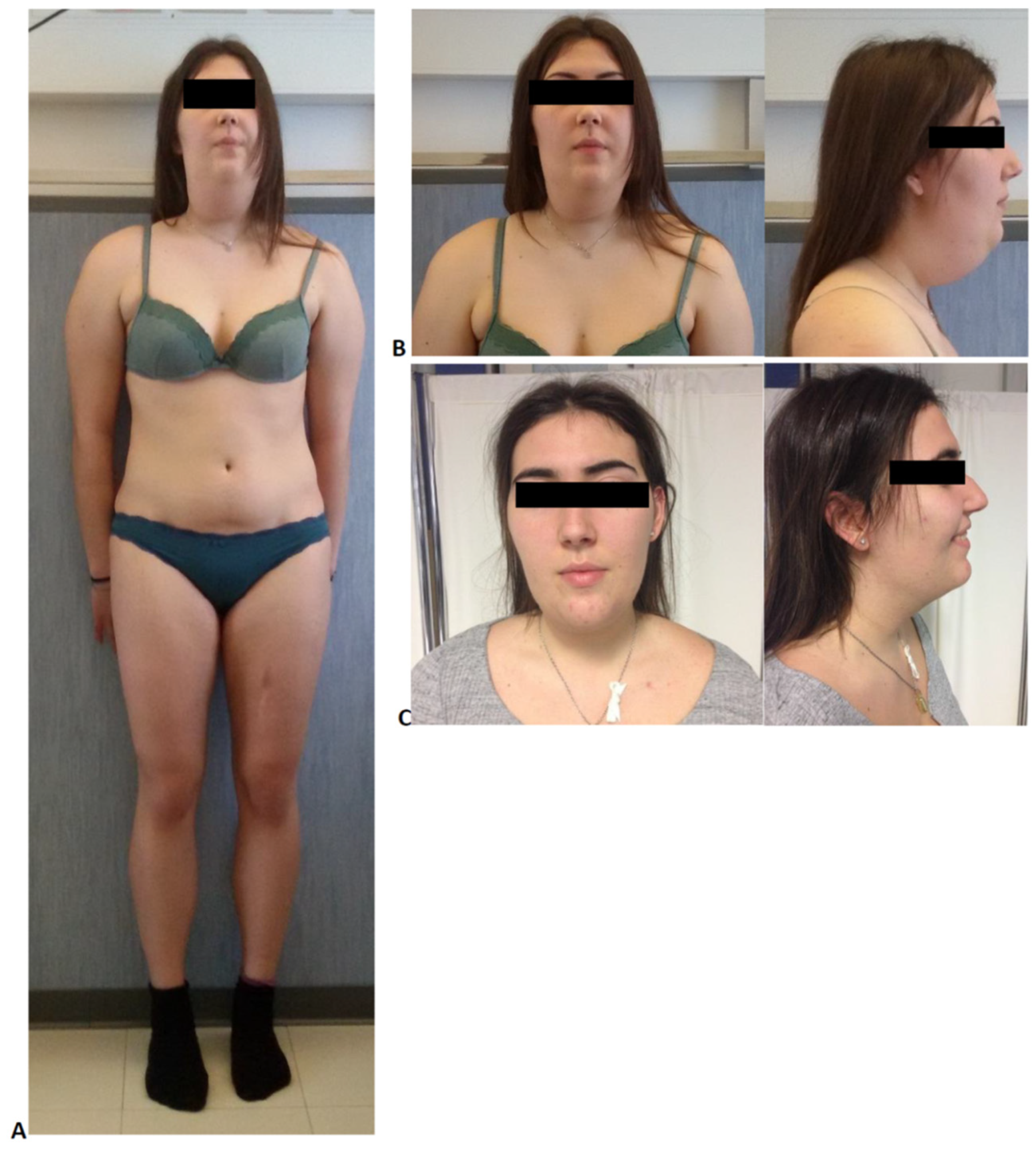 Jcm 10 01142 g002 Jcm 10 01142 g002