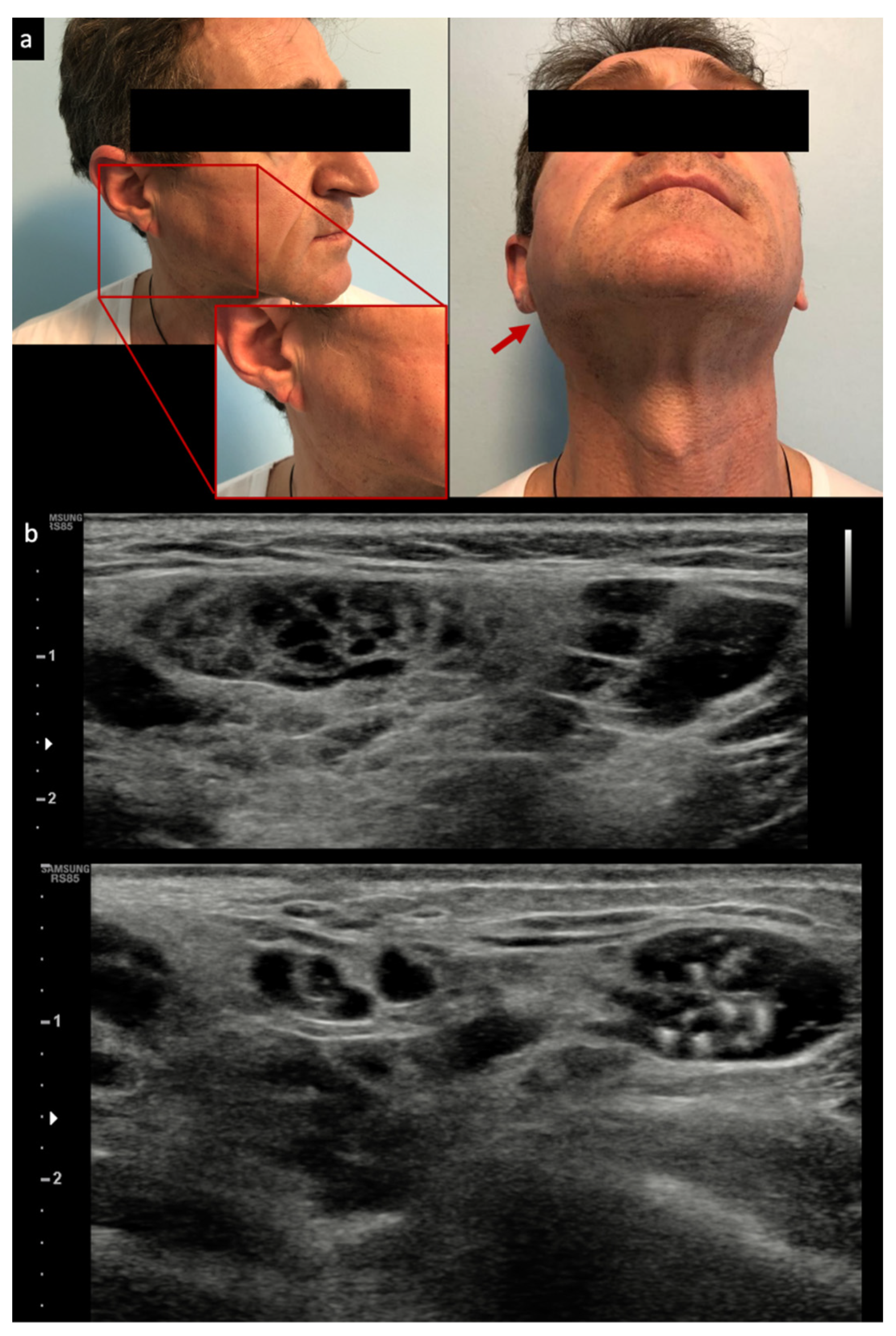 Jcm 10 01171 g001 Jcm 10 01171 g001