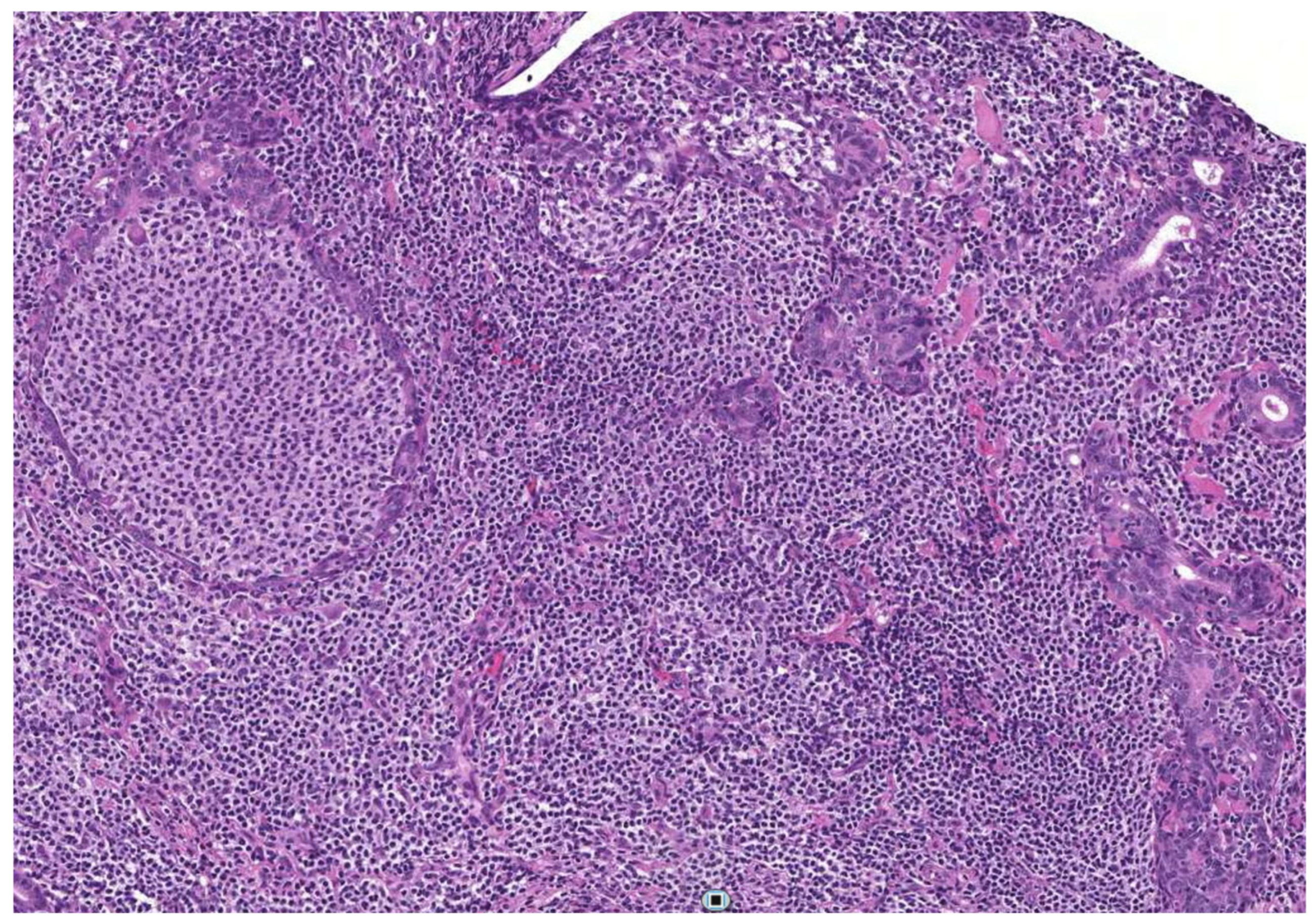 Jcm 10 01171 g002 Jcm 10 01171 g002