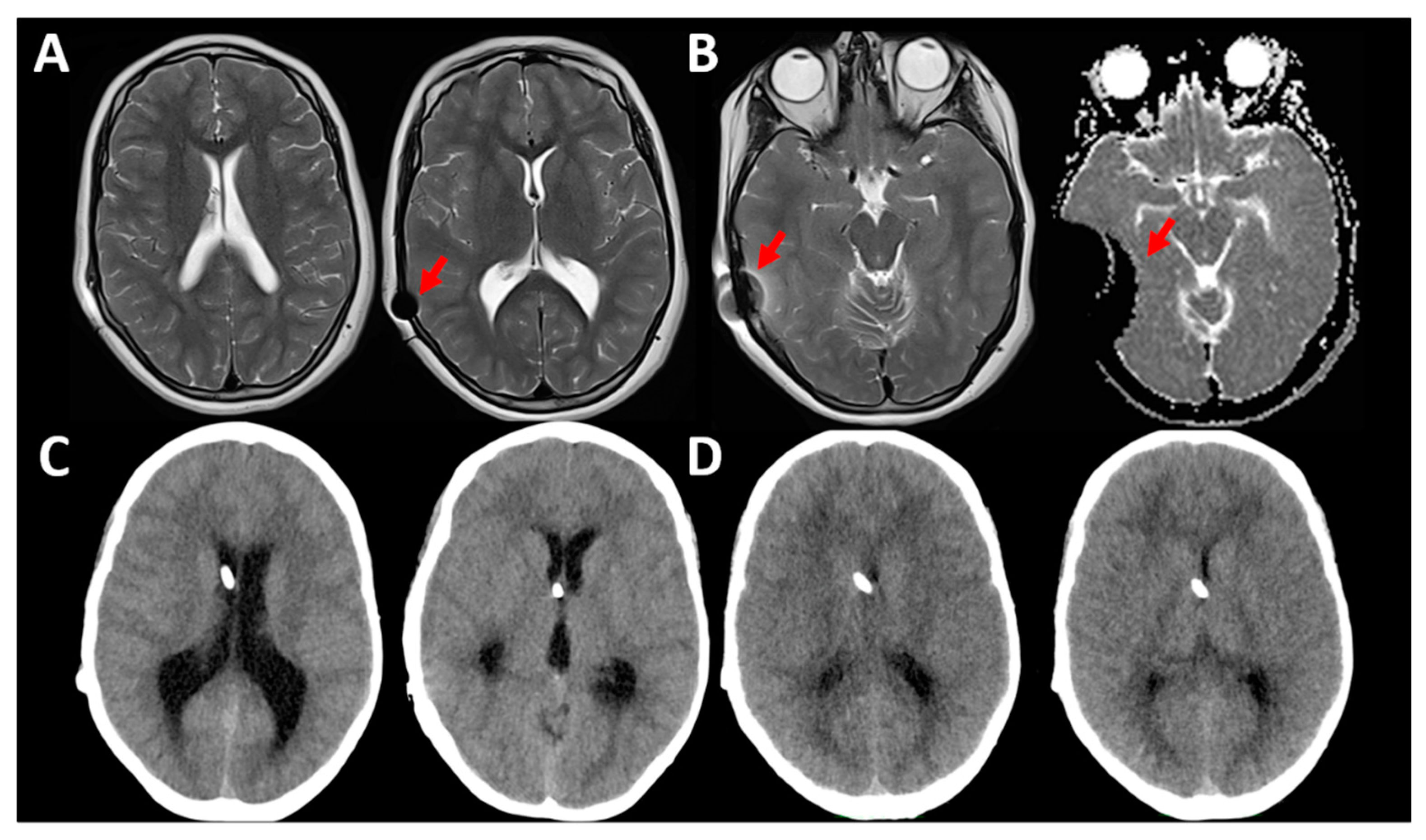 Jcm 10 01210 g008 Jcm 10 01210 g008