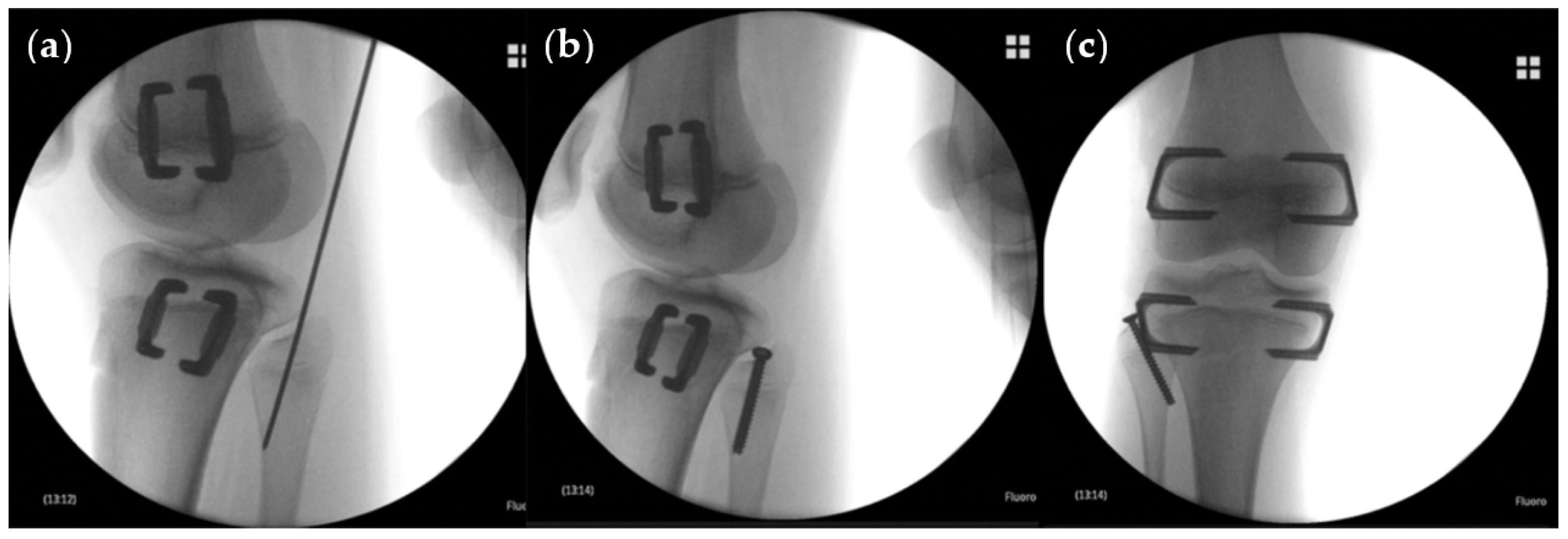 Jcm 10 01245 g003 Jcm 10 01245 g003