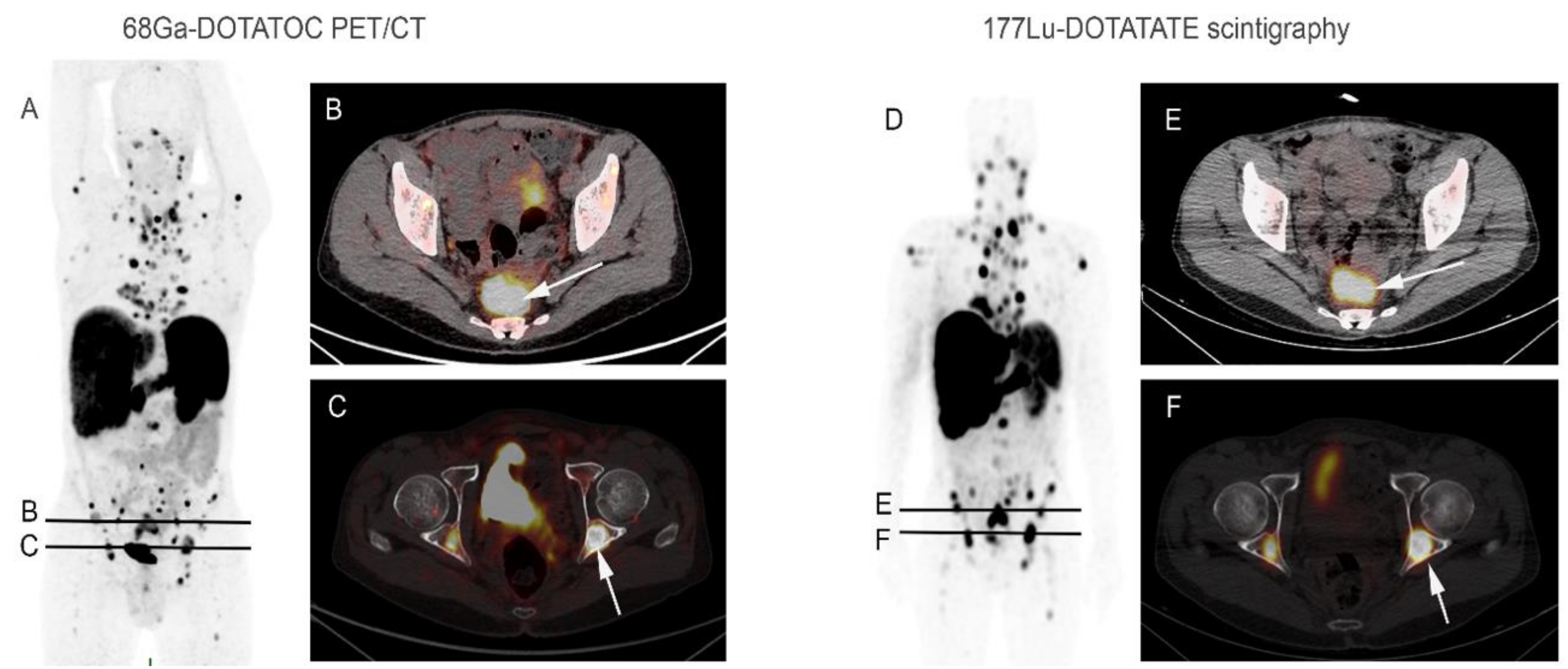 Jcm 10 01267 g001 Jcm 10 01267 g001