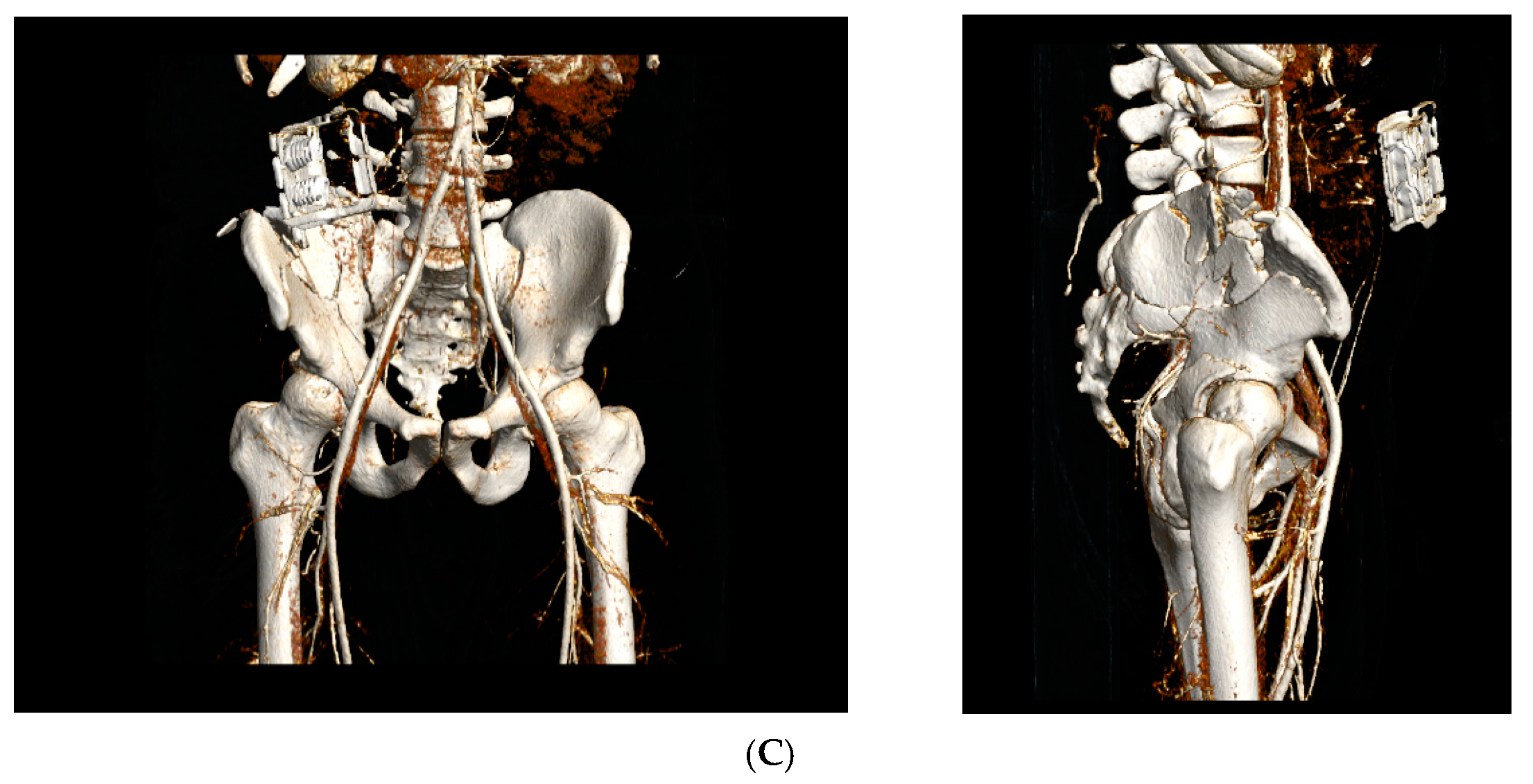 Jcm 10 01297 g001b Jcm 10 01297 g001b