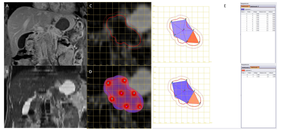 Jcm 10 01305 g002 Jcm 10 01305 g002