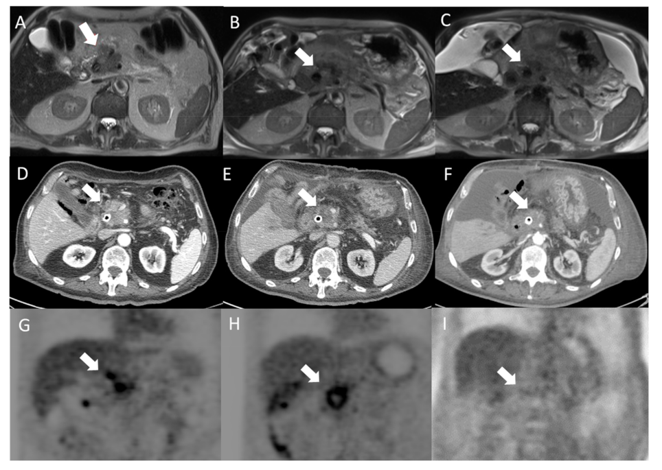 Jcm 10 01305 g005 Jcm 10 01305 g005