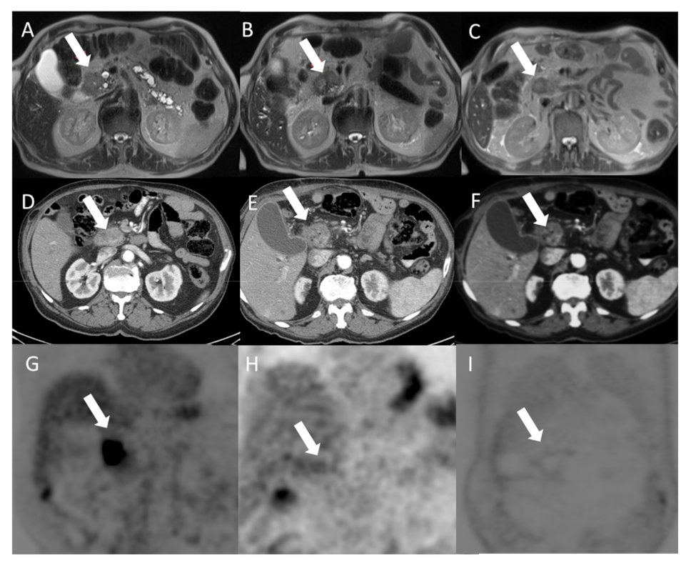 Jcm 10 01305 g006 Jcm 10 01305 g006