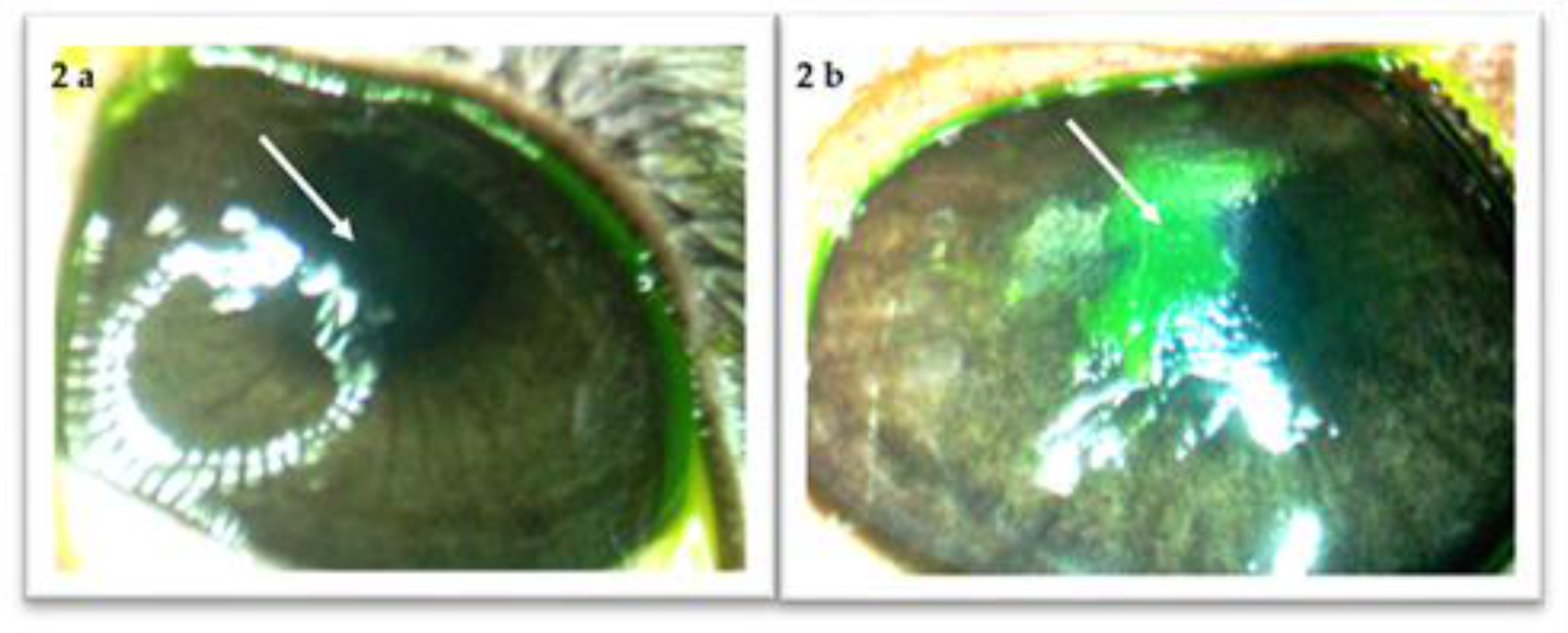 Jcm 10 01324 g002 Jcm 10 01324 g002