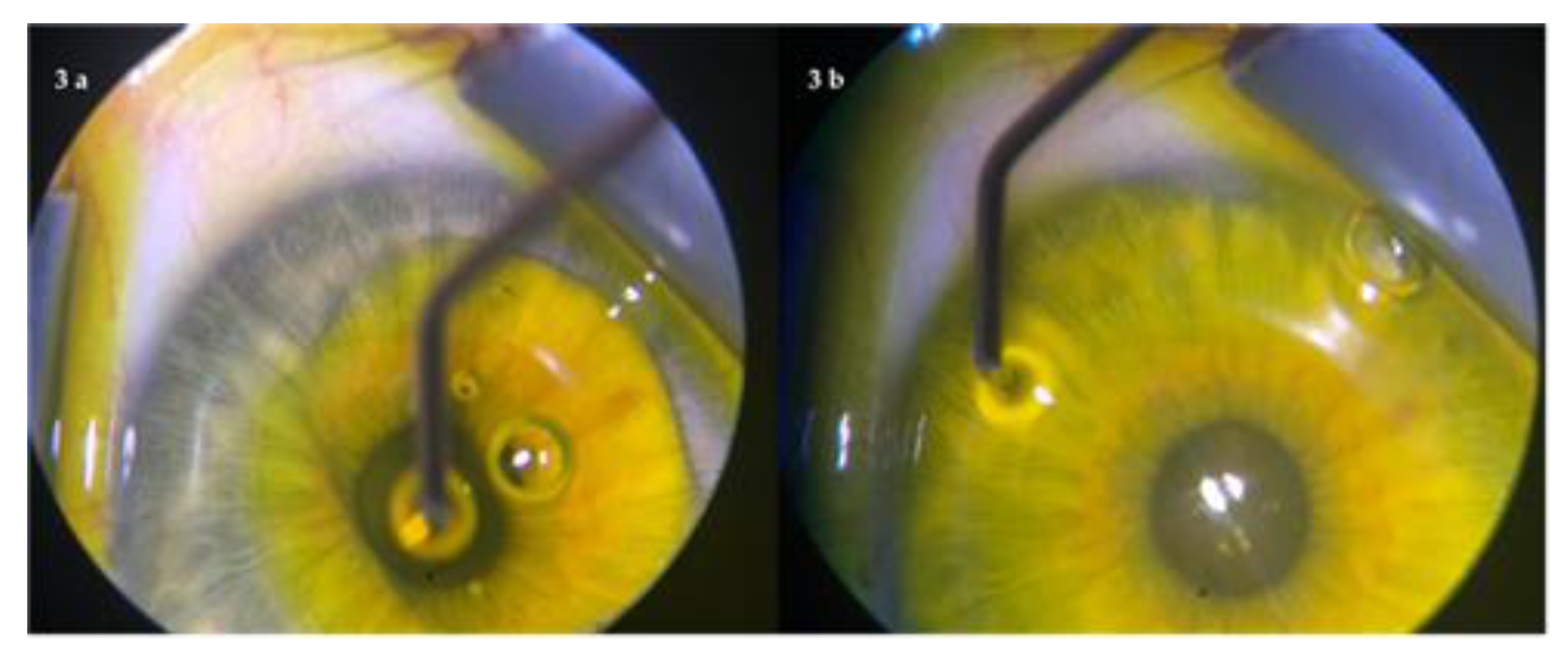 Jcm 10 01324 g003 Jcm 10 01324 g003