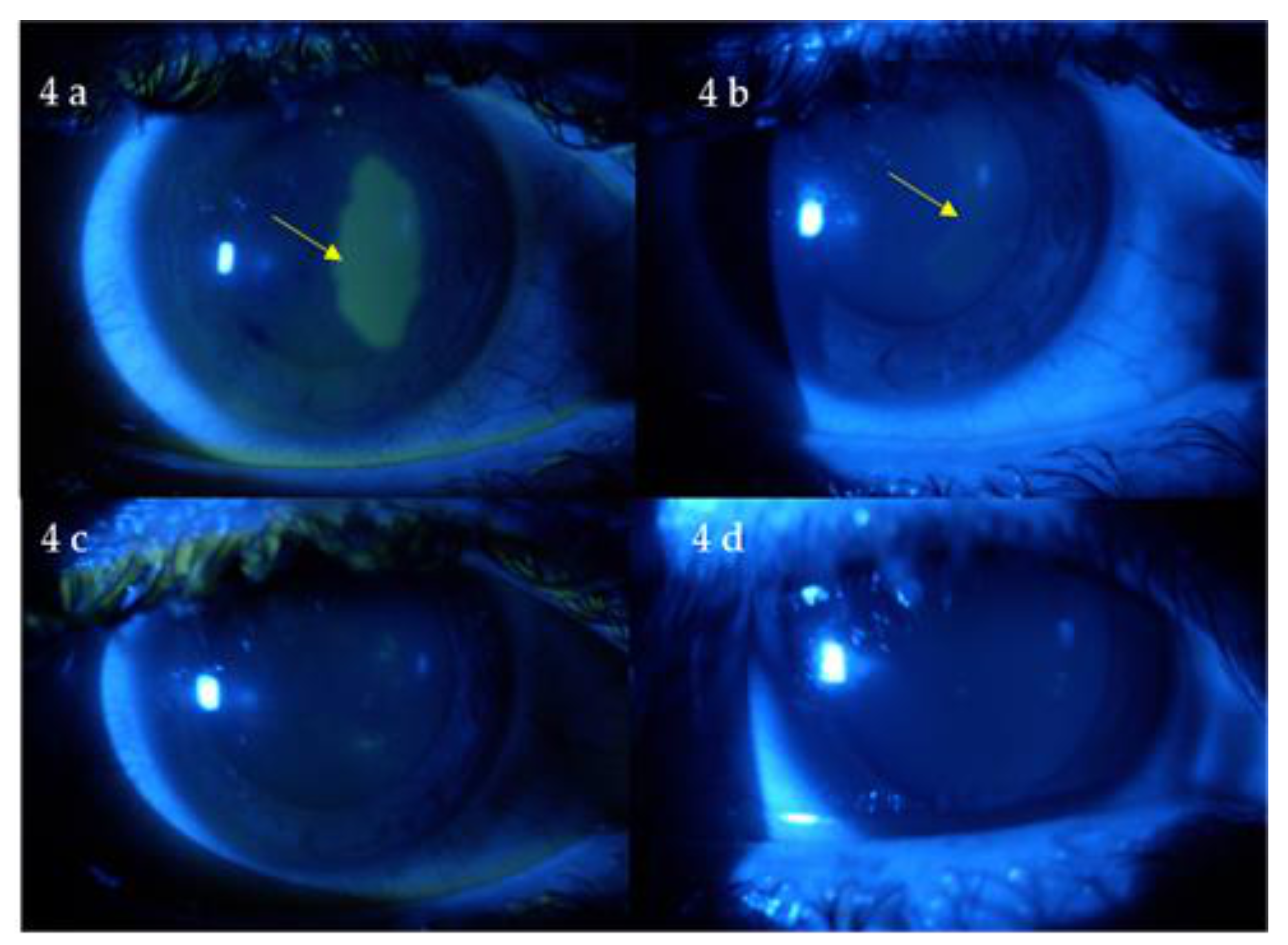 Jcm 10 01324 g004 Jcm 10 01324 g004
