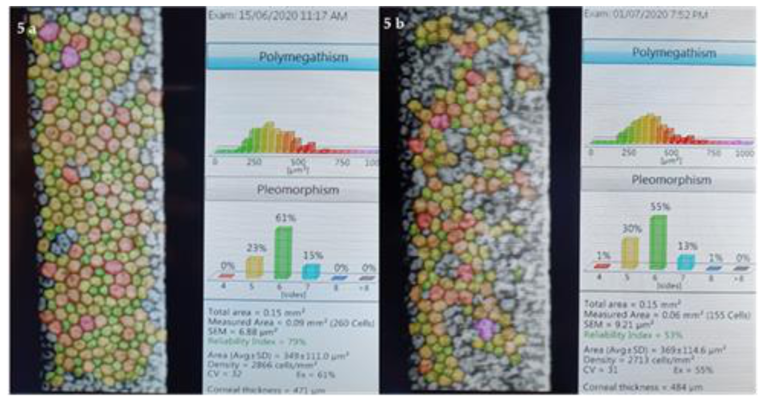 Jcm 10 01324 g005 Jcm 10 01324 g005