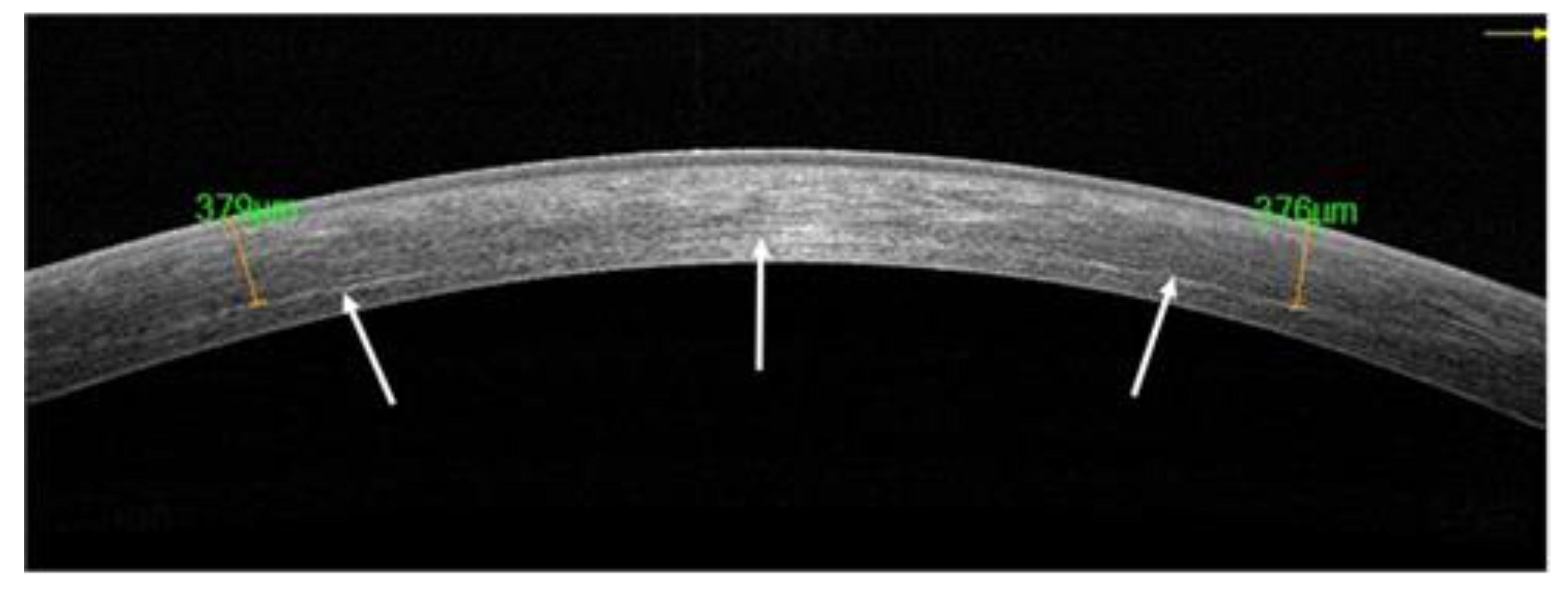 Jcm 10 01324 g006 Jcm 10 01324 g006