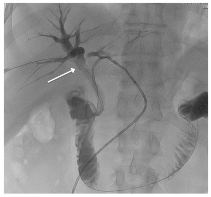 Jcm 10 01372 g001 Jcm 10 01372 g001