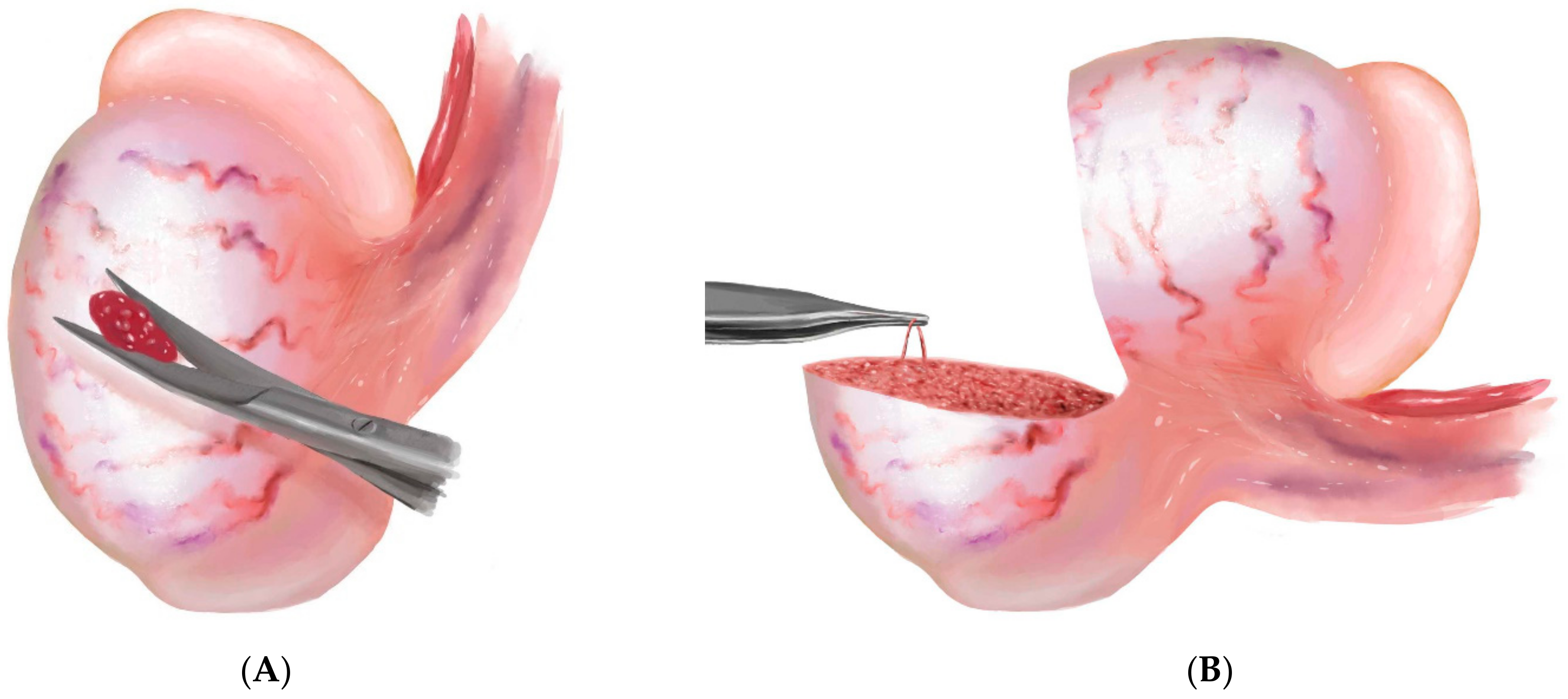 Jcm 10 01374 g002 Jcm 10 01374 g002