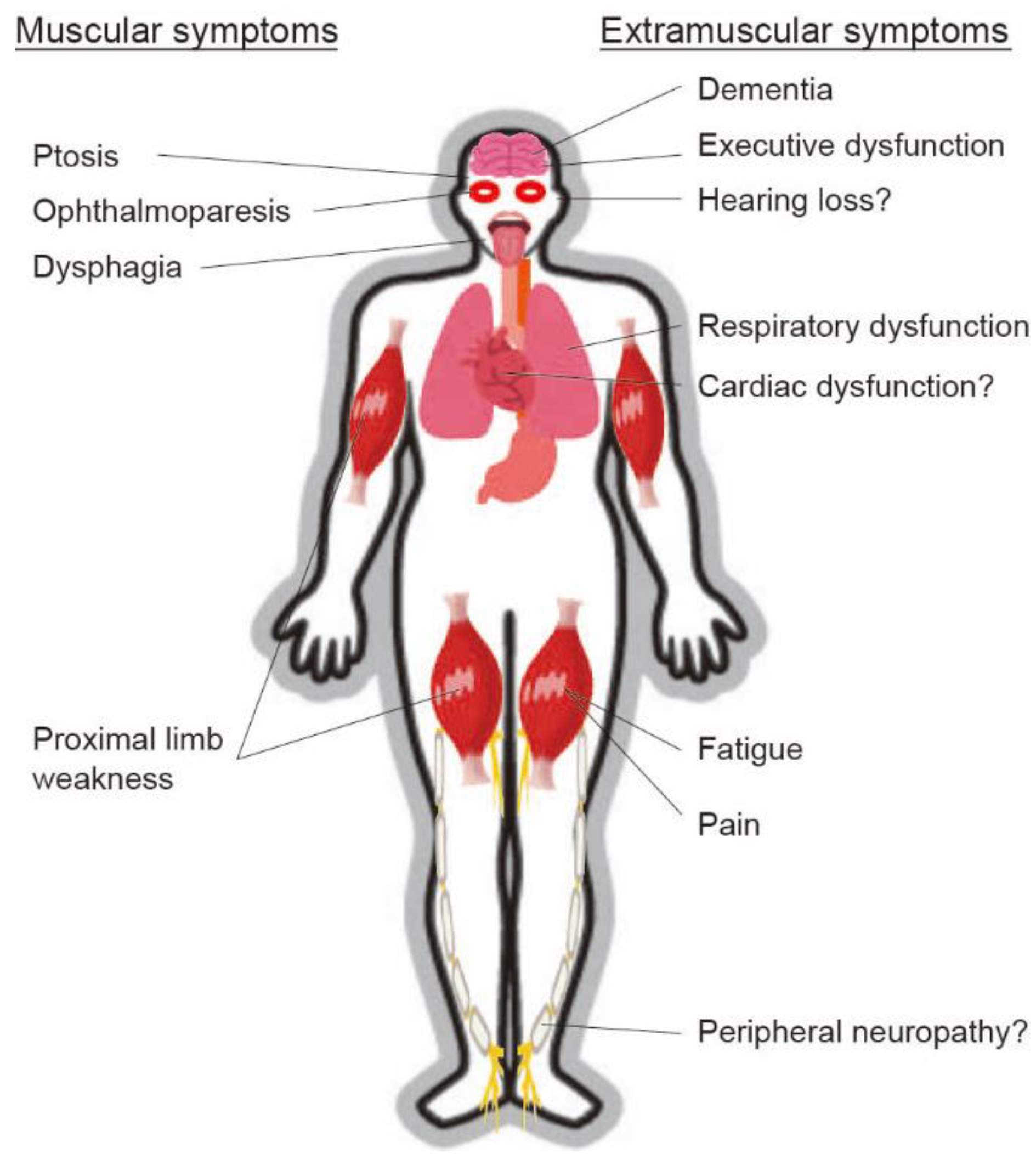 Featured image of post The Best 22 Oculopharyngeal Muscular Dystrophy Images