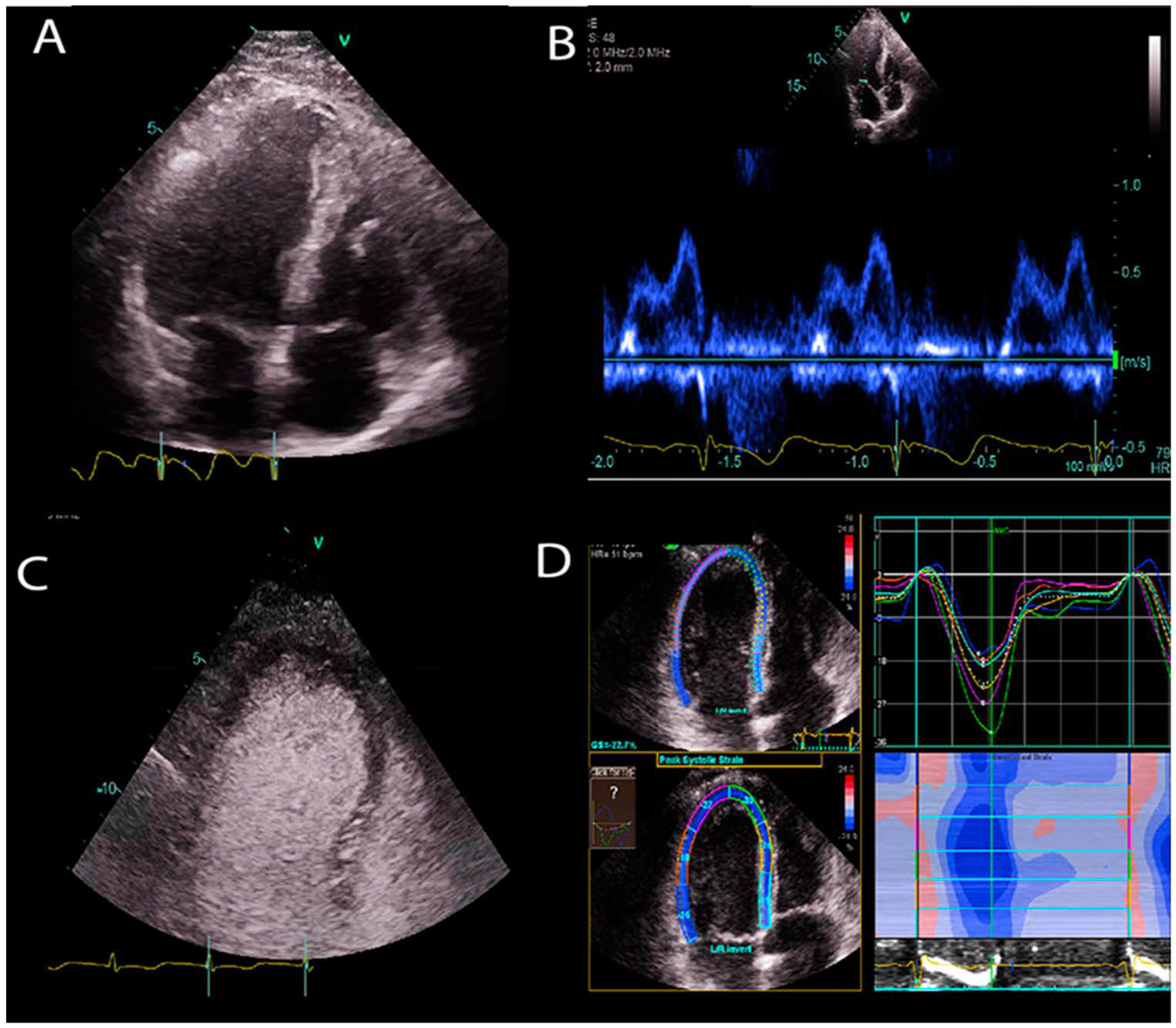 AI-powered interpretable imaging phenotypes noninvasively