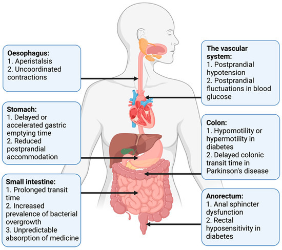 diabetic autonomic neuropathy diarrhea treatment)