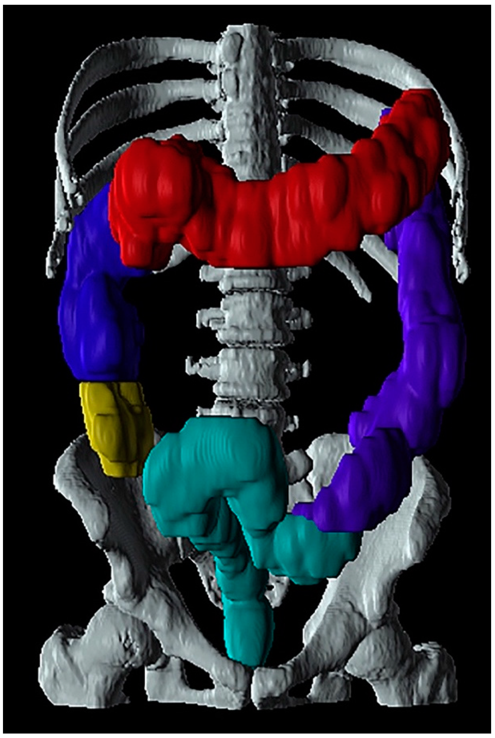 Jcm 10 01392 g003 Jcm 10 01392 g003